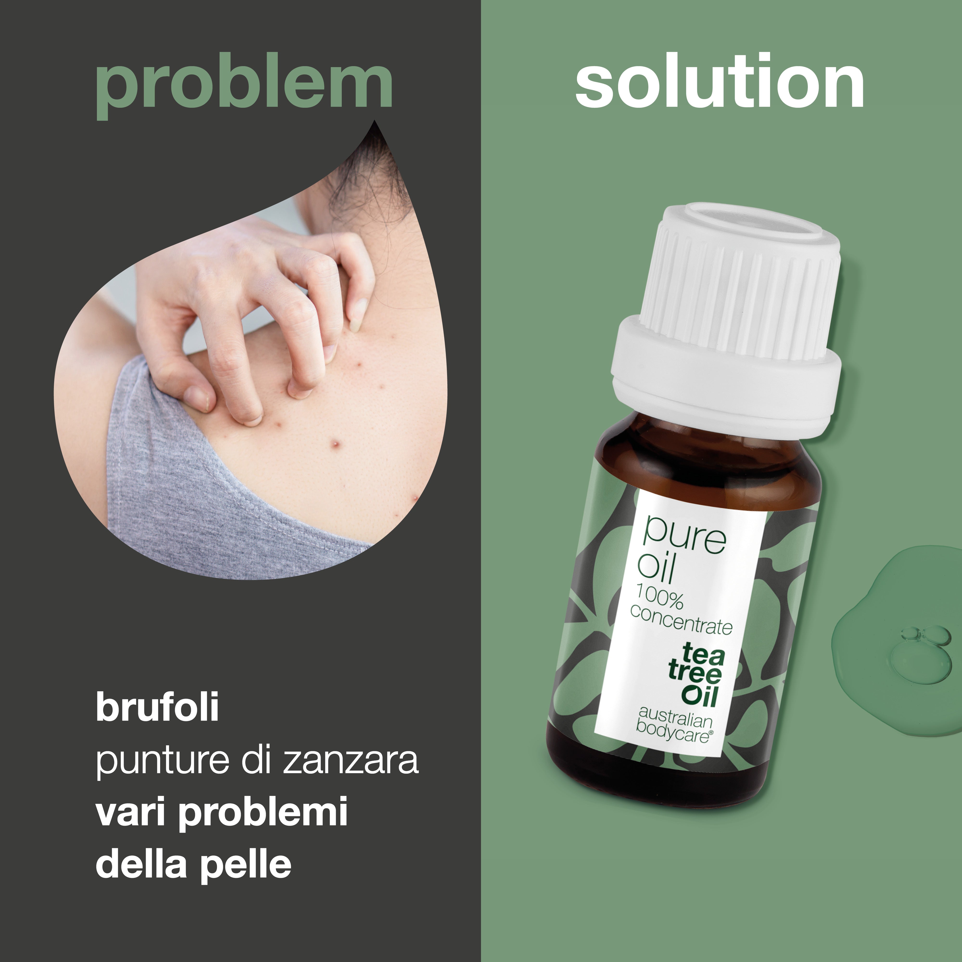 Tea Tree Oil puro concentrato— Tea Tree Oil australiano 100% naturale e non diluito