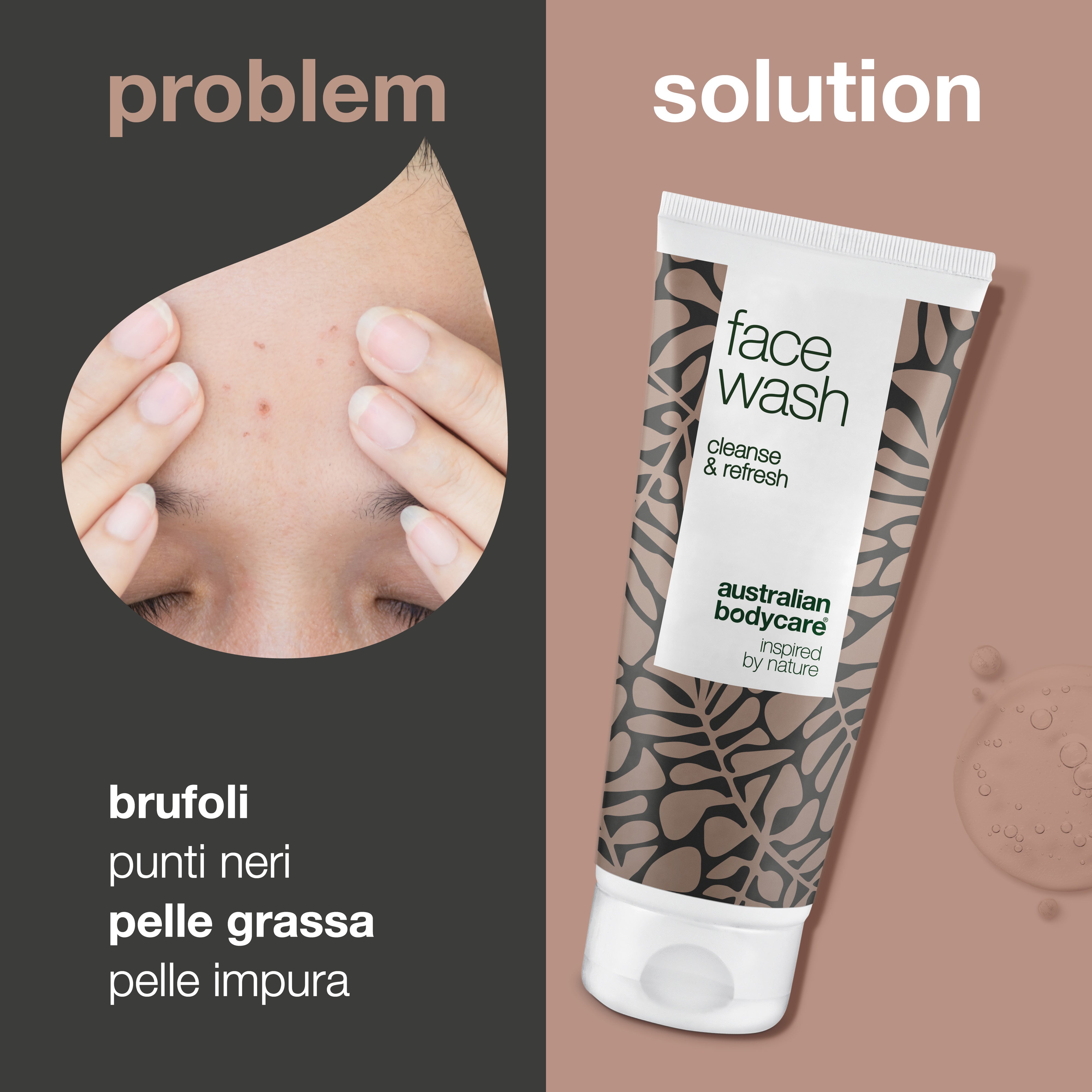 Detergente viso Tea Tree per brufoli e punti neri — Detergente quotidiano per pelle grassa, ideale per pelle impura e acneica