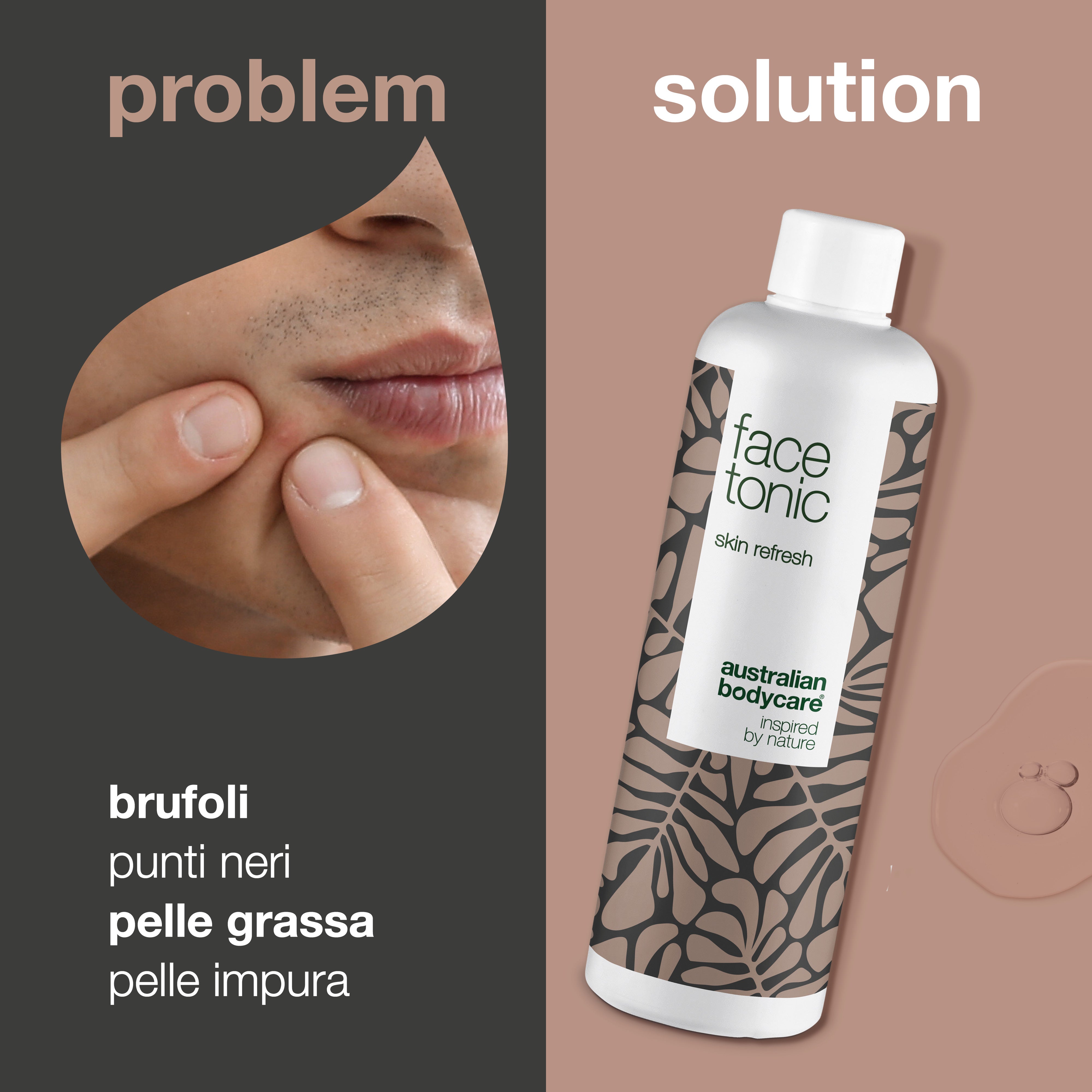 Tonico viso per la pulizia profonda quotidiana - Tonico viso all'olio di melaleuca per brufoli, punti neri e pelle grassa