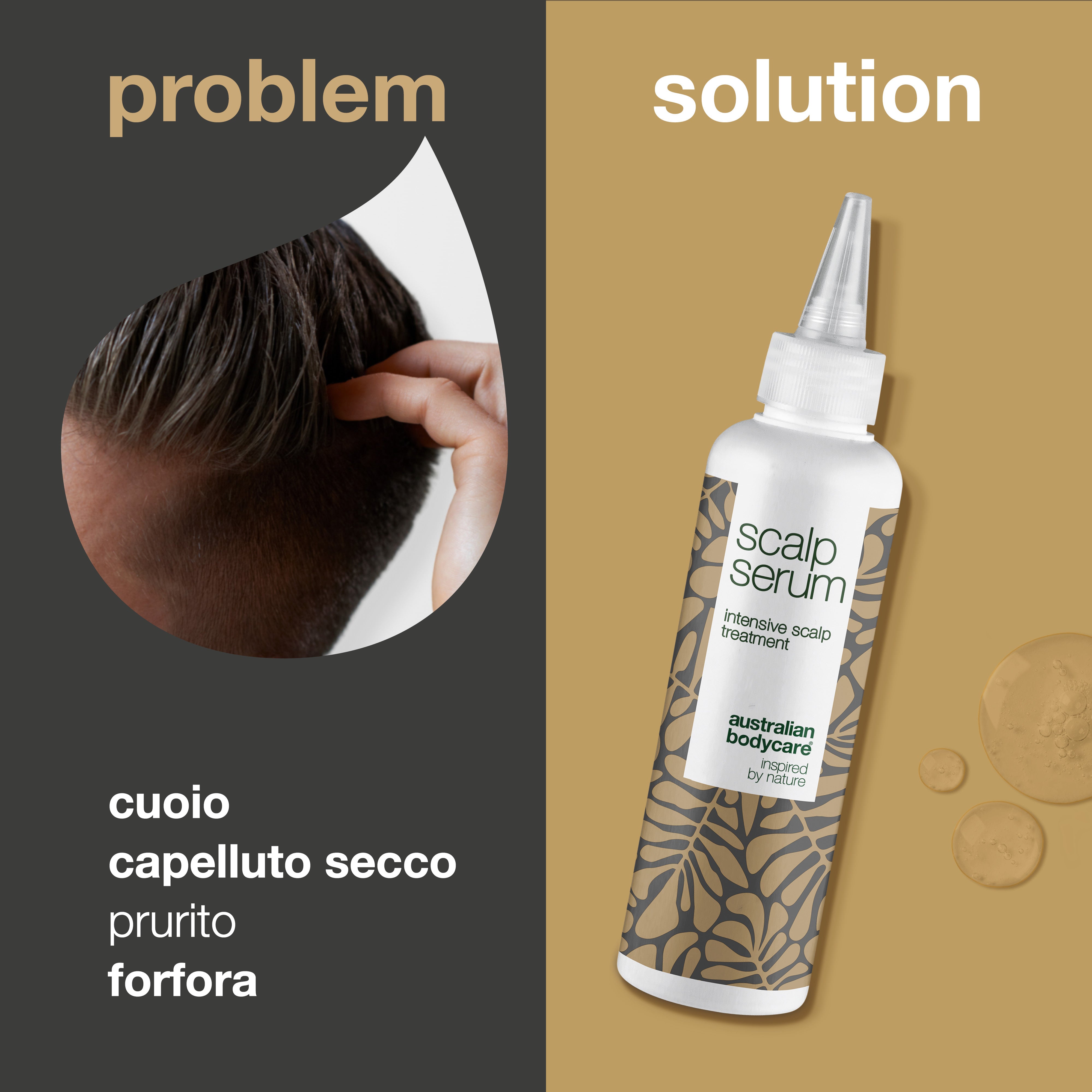 Trattamento del cuoio capelluto per forfora e cuoio capelluto secco - Siero per cuoio capelluto pruriginoso, capelli grassi, cuoio capelluto secco e irritato