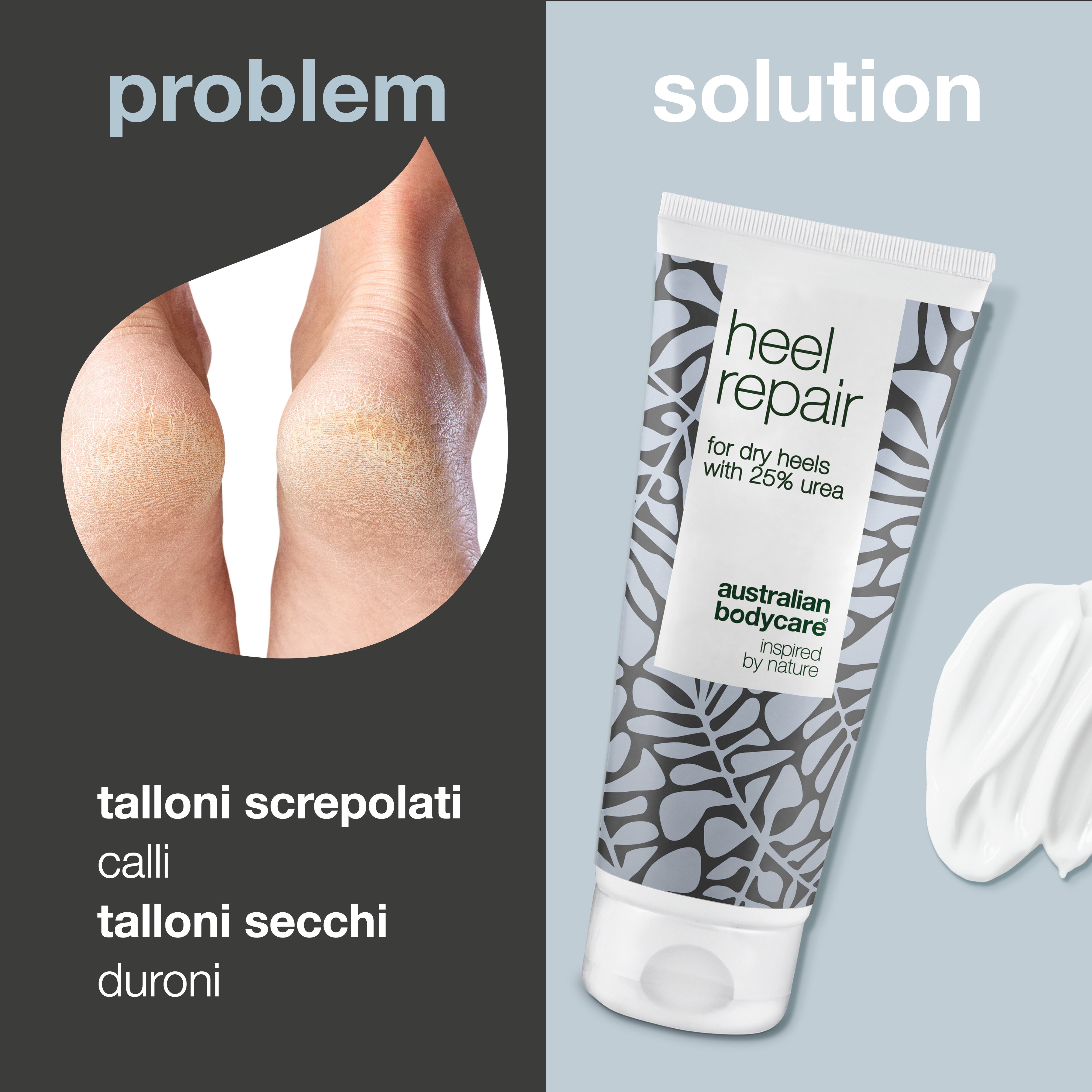 Crema per talloni secchi e screpolati: affronta i talloni screpolati e i piedi secchi con la nostra riparazione per talloni. Contiene il 25% di urea e 4-terpineolo naturale, noto dall'olio dell'albero del tè.