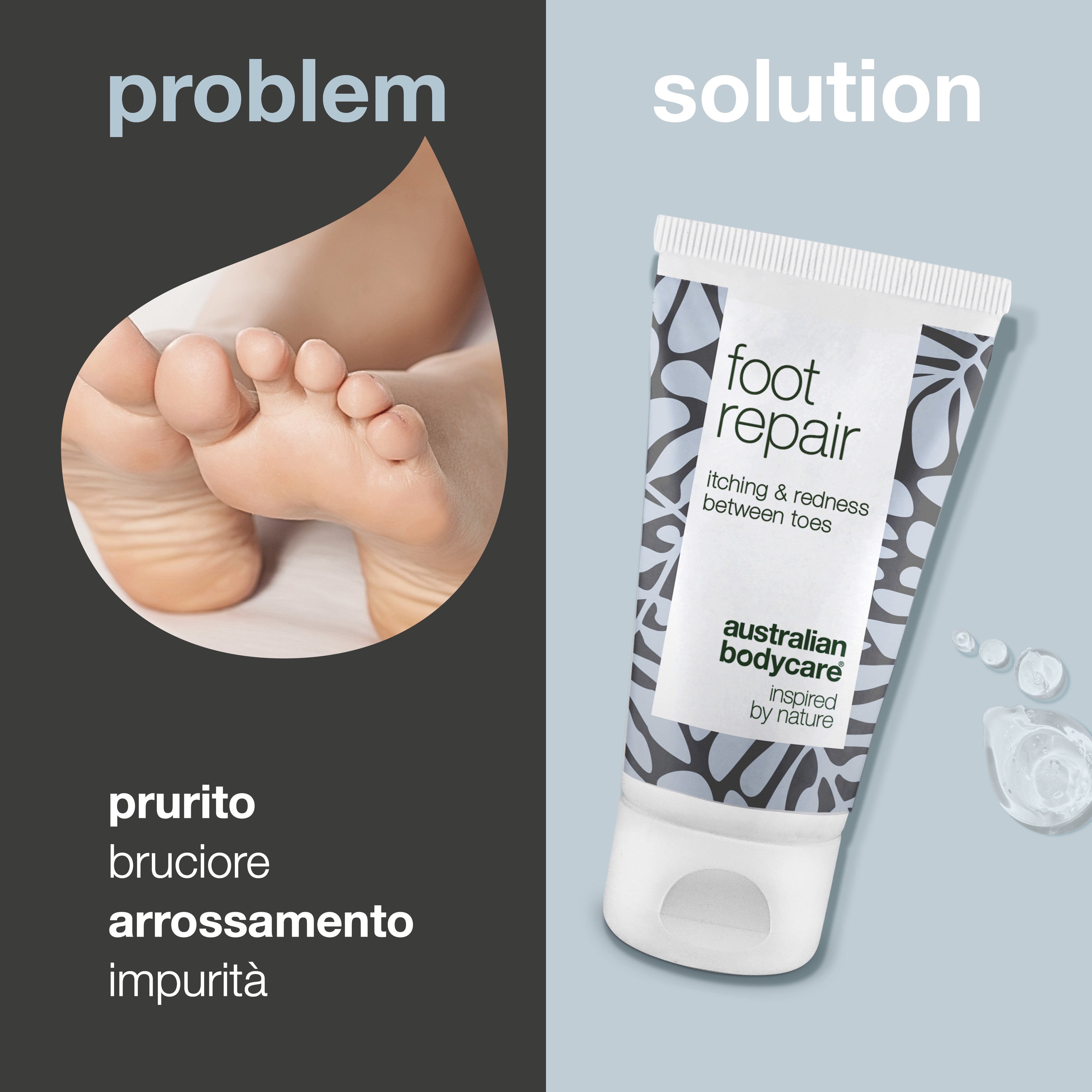 Gel piedi per dita rosse e pruriginose — Allevia il prurito, il formicolio e il rossore tra le dita dei piedi con questo gel lenitivo. Contiene 4-terpineolo naturale, noto dall'olio dell'albero del tè. Ideale per la cura e il sollievo quotidiano.
