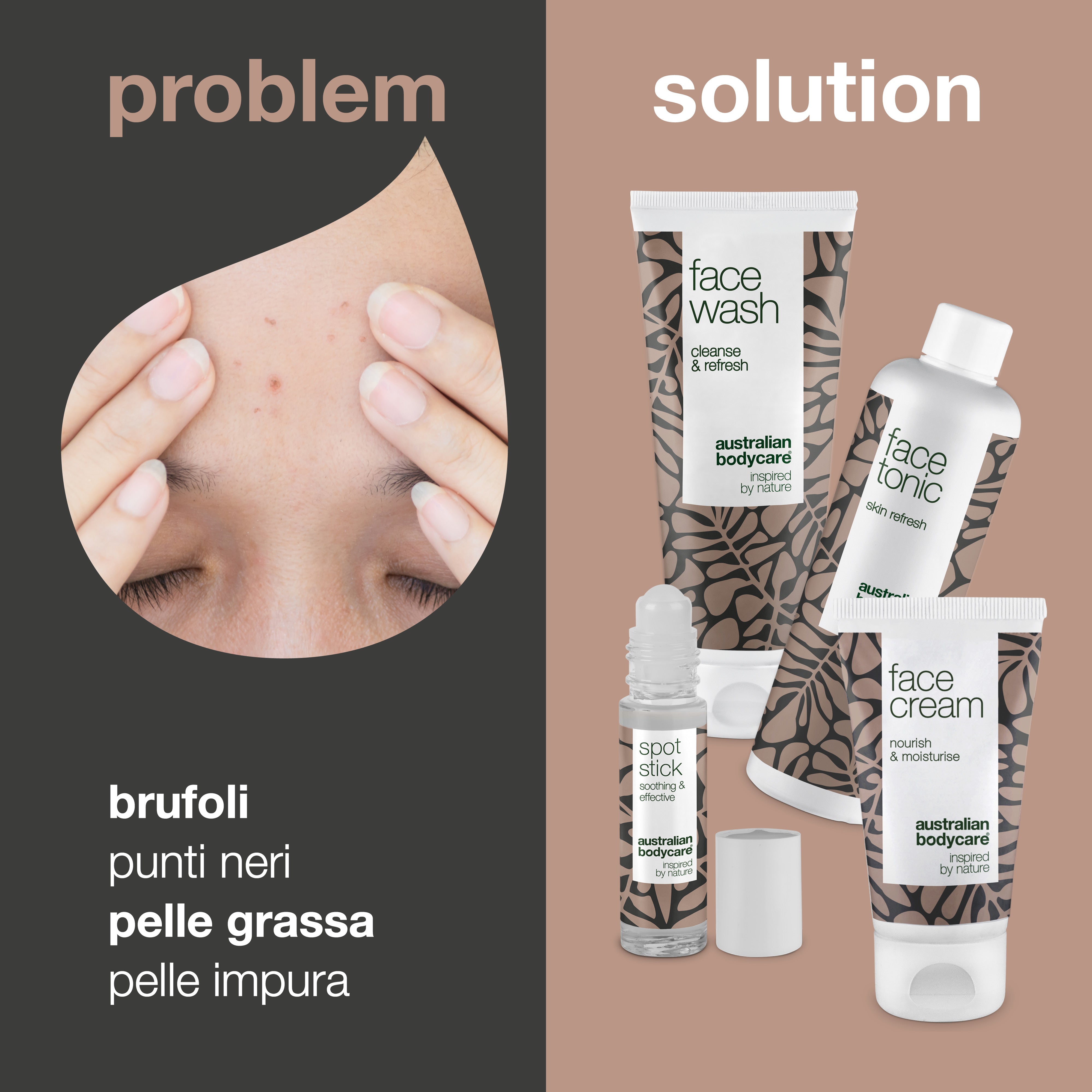 Kit per la cura del viso contro le imperfezioni della pelle: 4 dei migliori prodotti per i punti neri, l'eliminazione delle macchie sul viso e la cura quotidiana dell'acne