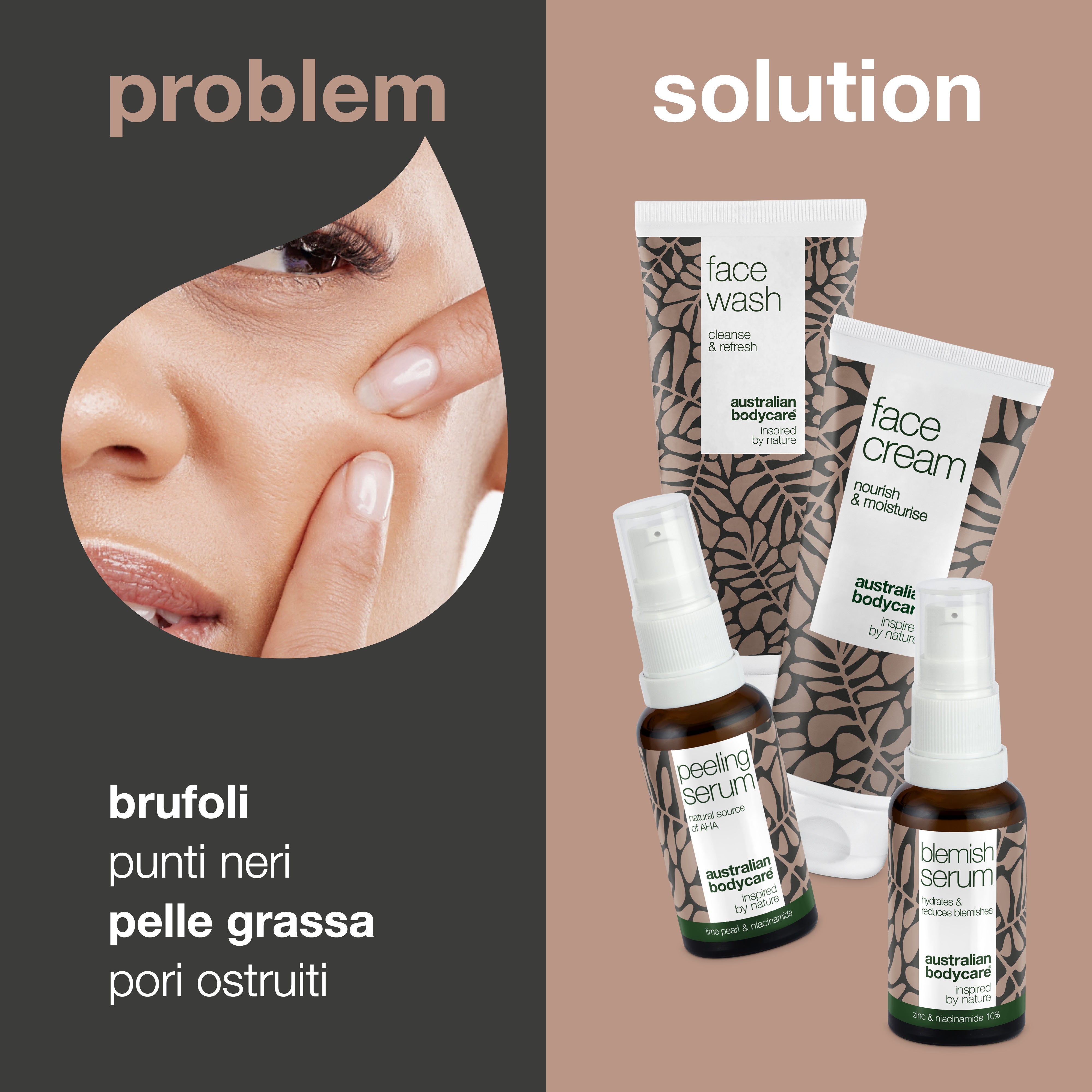 Set per la cura della pelle congestionata e delle macchie sul viso: 4 prodotti per la pulizia profonda della pelle grassa, dei brufoli e dei punti neri