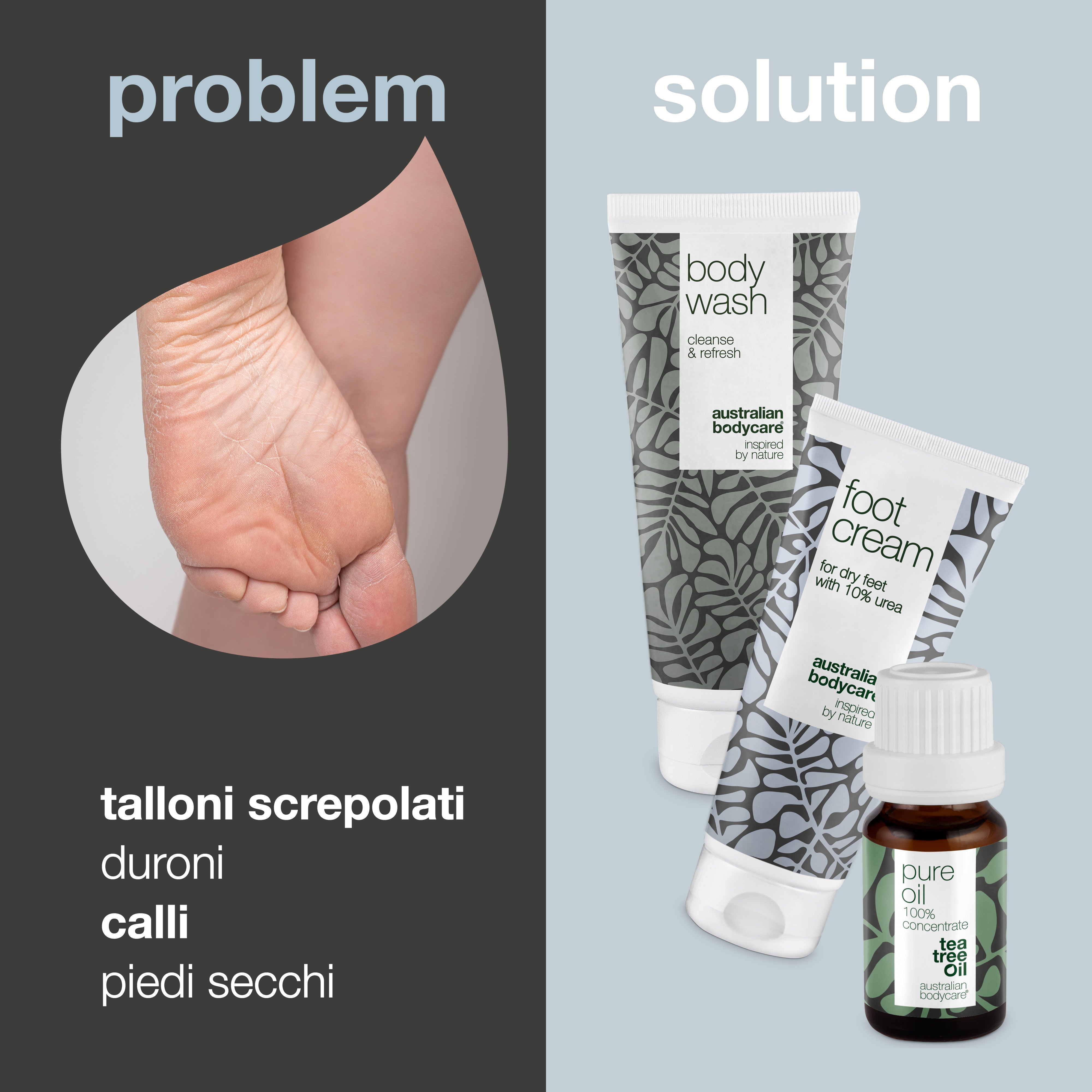 3 prodotti per la pelle dura e i calli su piedi e talloni — Previene e neutralizza le screpolature del tallone, i calli, i calli e la pelle dura sui piedi