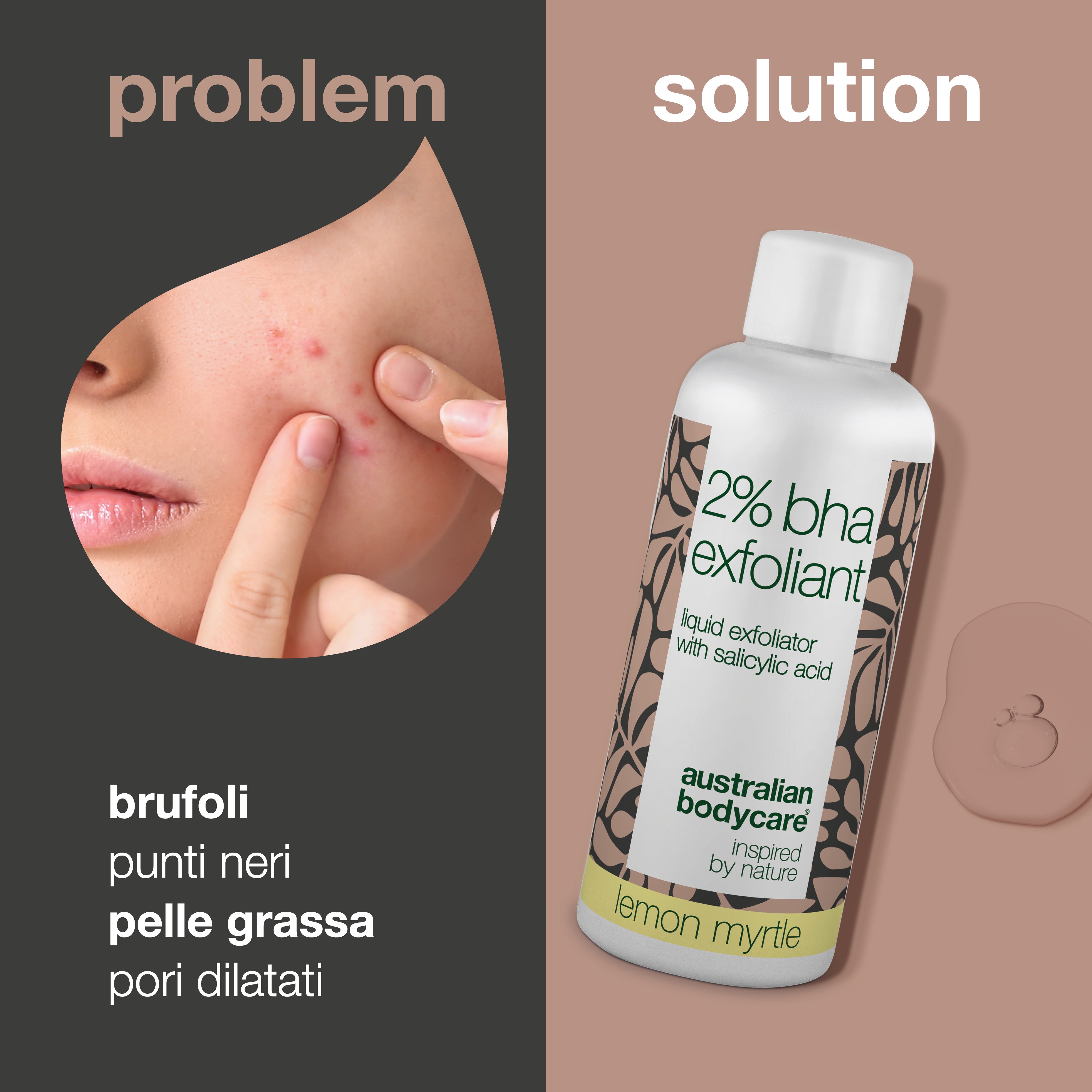 Esfoliante all'acido salicilico al 2% di BHA per pelli grasse e impure: ottieni una pelle chiara e liscia con il nostro esfoliante naturale. Riduce punti neri, brufoli e pori dilatati.