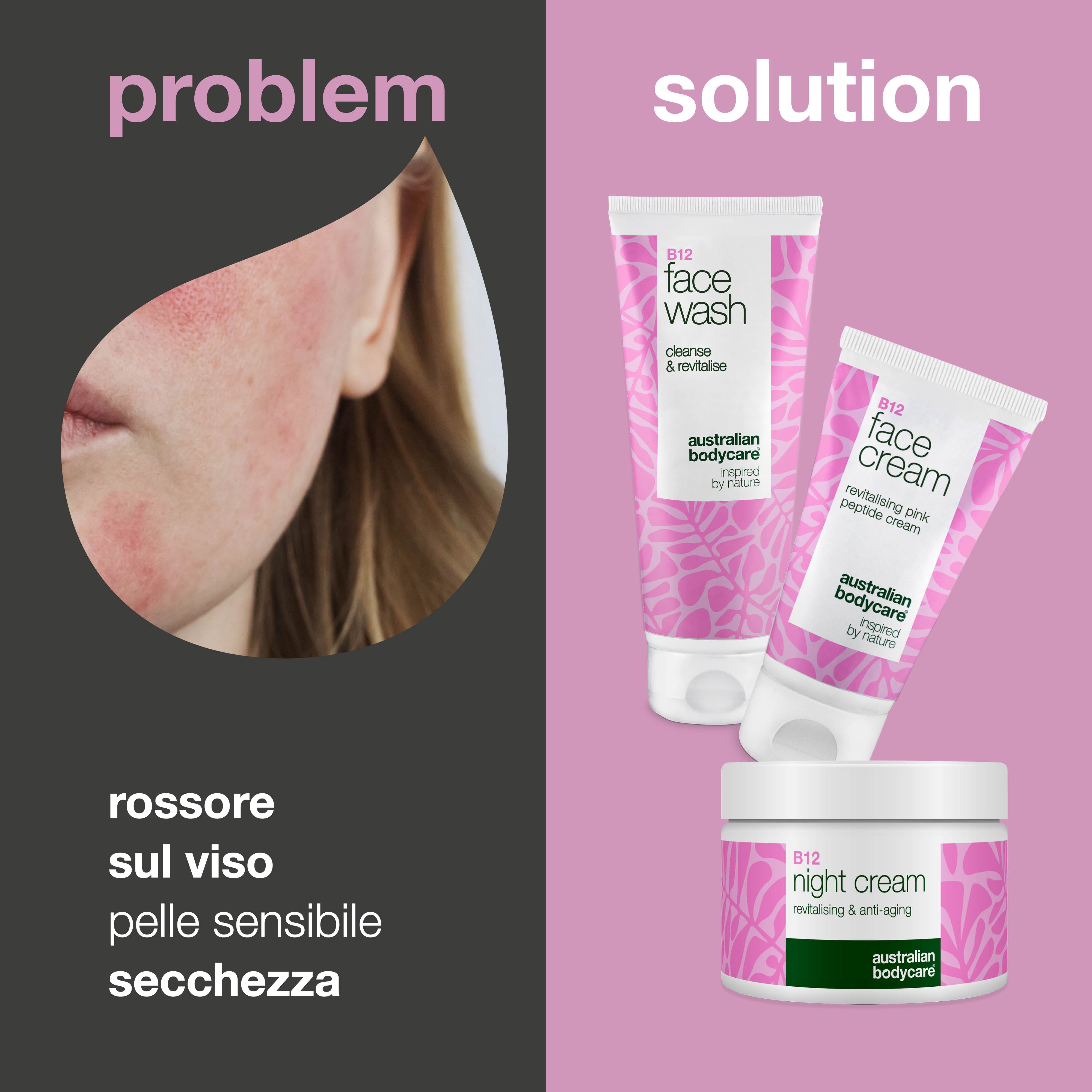Set di cura B12 per arrossamenti – Detergente, crema da giorno e da notte – Cura B12 per la pelle soggetta ad arrossamenti e rosacea. Detergente, crema da giorno e crema da notte che leniscono e idratano.