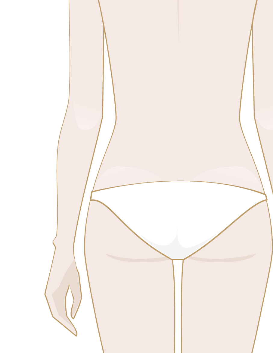 Smagliature sul sedere? Come renderle meno visibili »