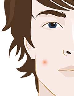 Macchie pelle vecchiaia e come affrontarle