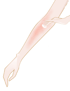 Sudamina: cos'è e come si evita?