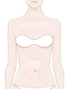 pelle a buccia d'arancia