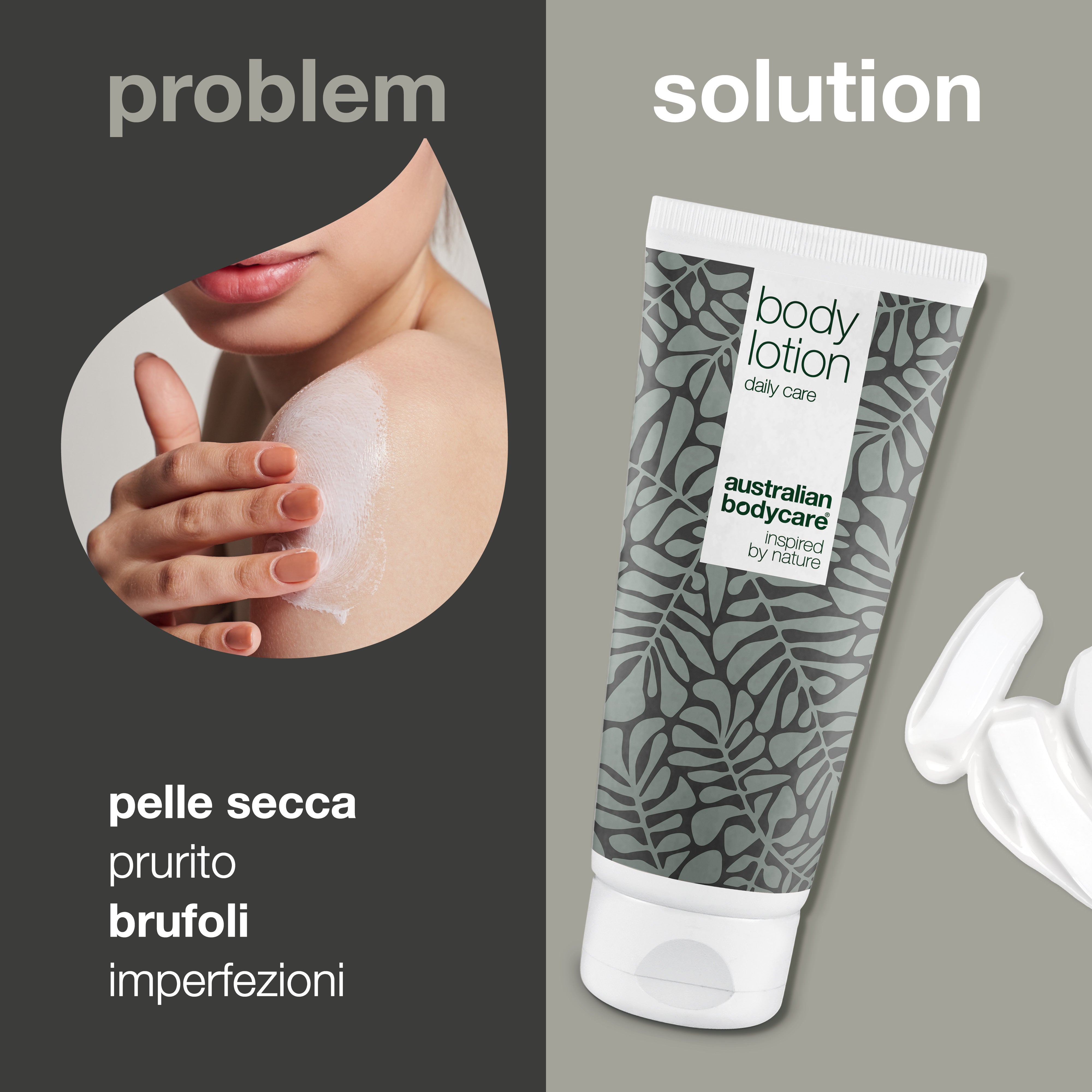 Lozione per il corpo all'albero del tè per pelle secca e macchie - Crema idratante per la pelle del corpo congestionata e squamosa