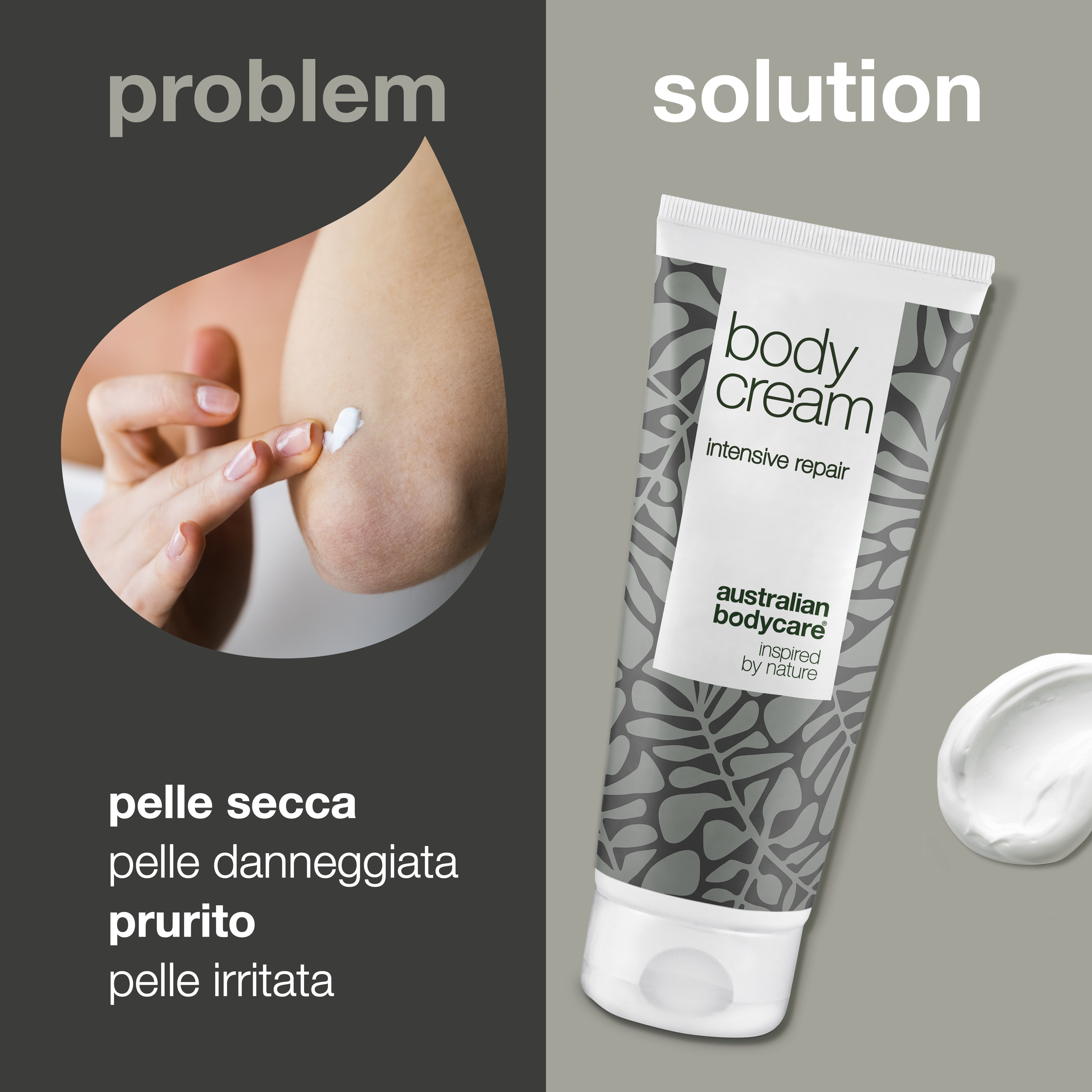Crema corpo per pelli molto secche e pruriginose - Crema idratante corpo intensiva per pelli danneggiate, molto secche e pruriginose