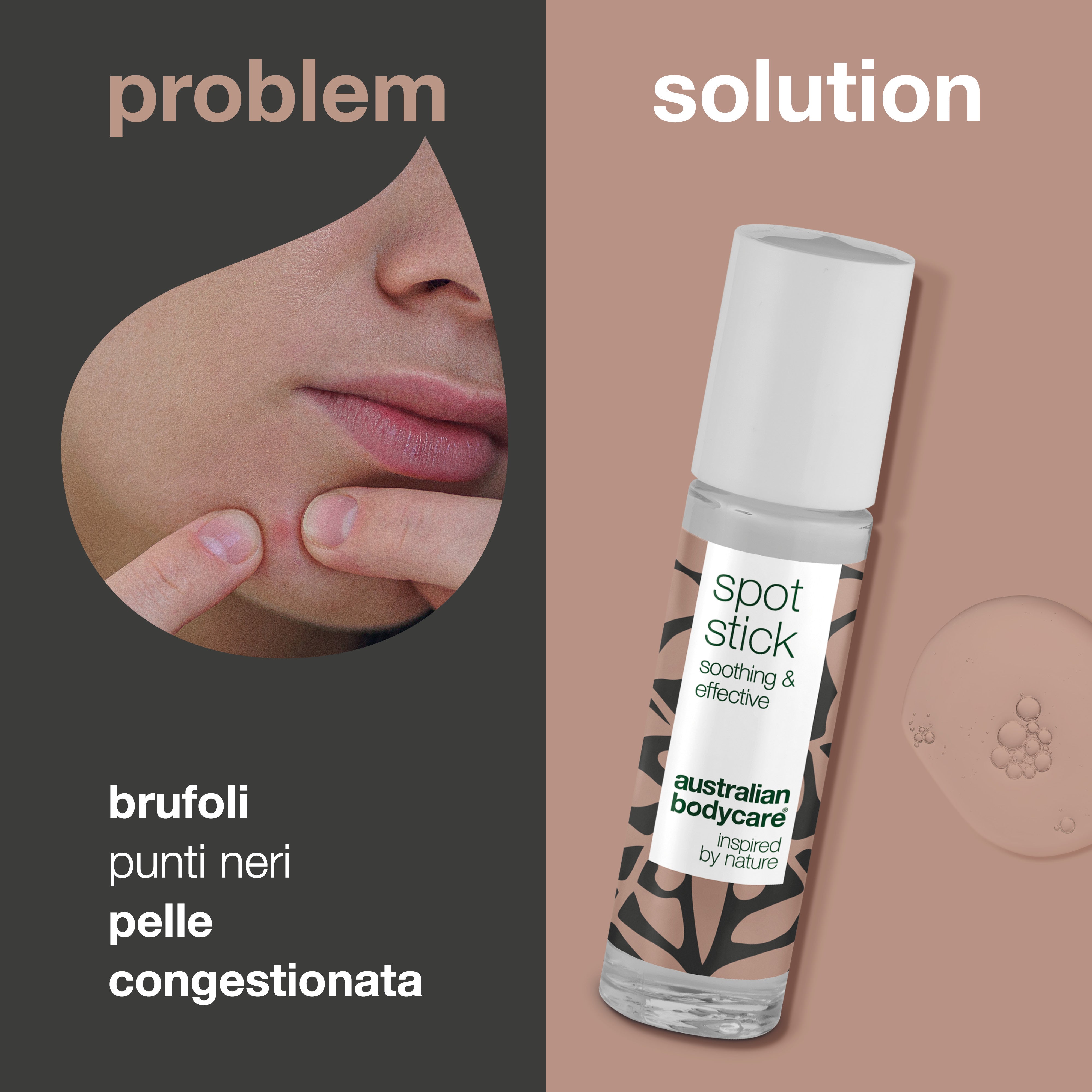 Roll on anti brufoli — Con Tea Tree Oil australiano e amamelide, per eliminare brufoli e punti neri