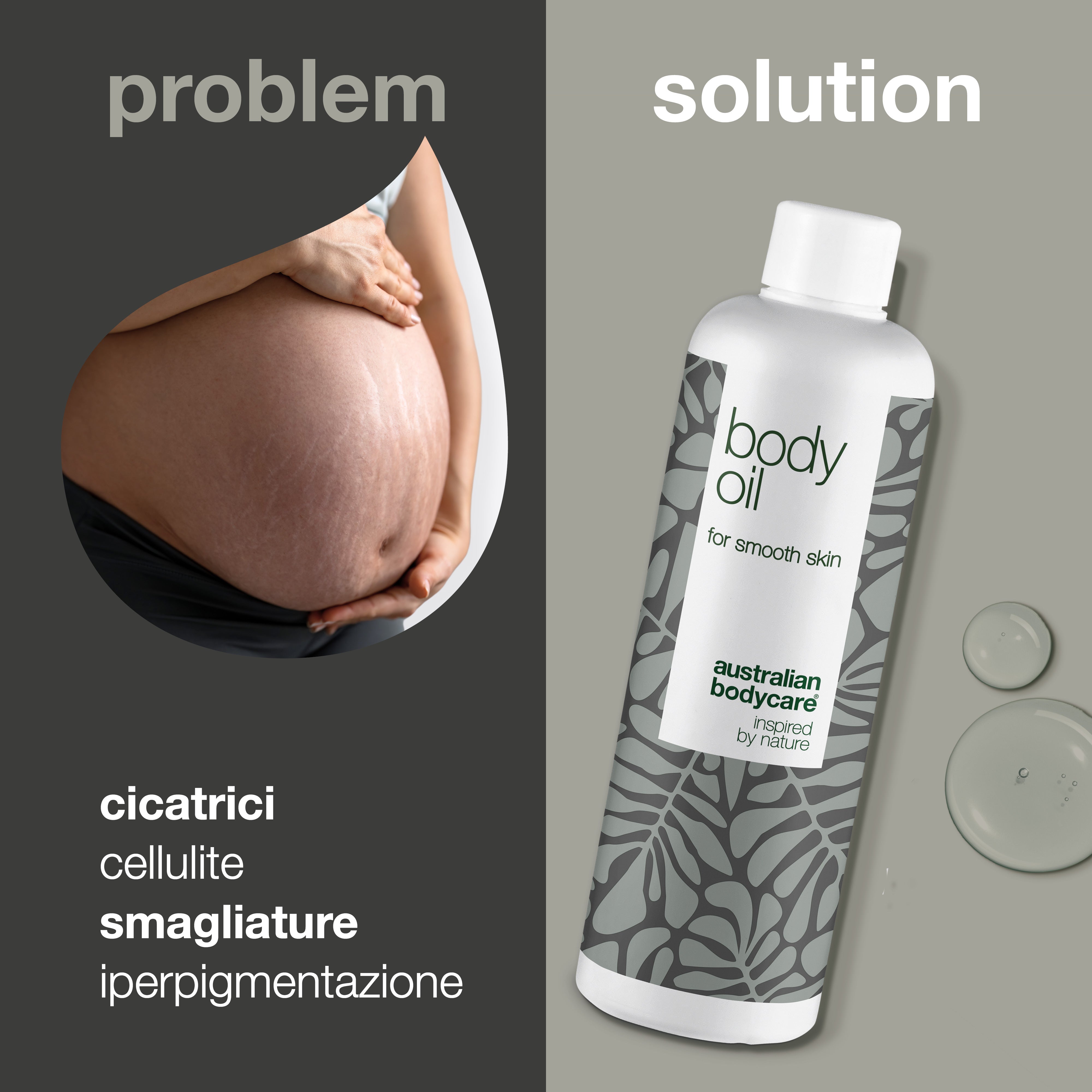 Body Oil – Riduce smagliature, cicatrici e macchie scure — Body Oil riduce smagliature, cicatrici e macchie. Con olio di mandorle, squalano e vitamina E, idrata e rende la pelle più morbida.