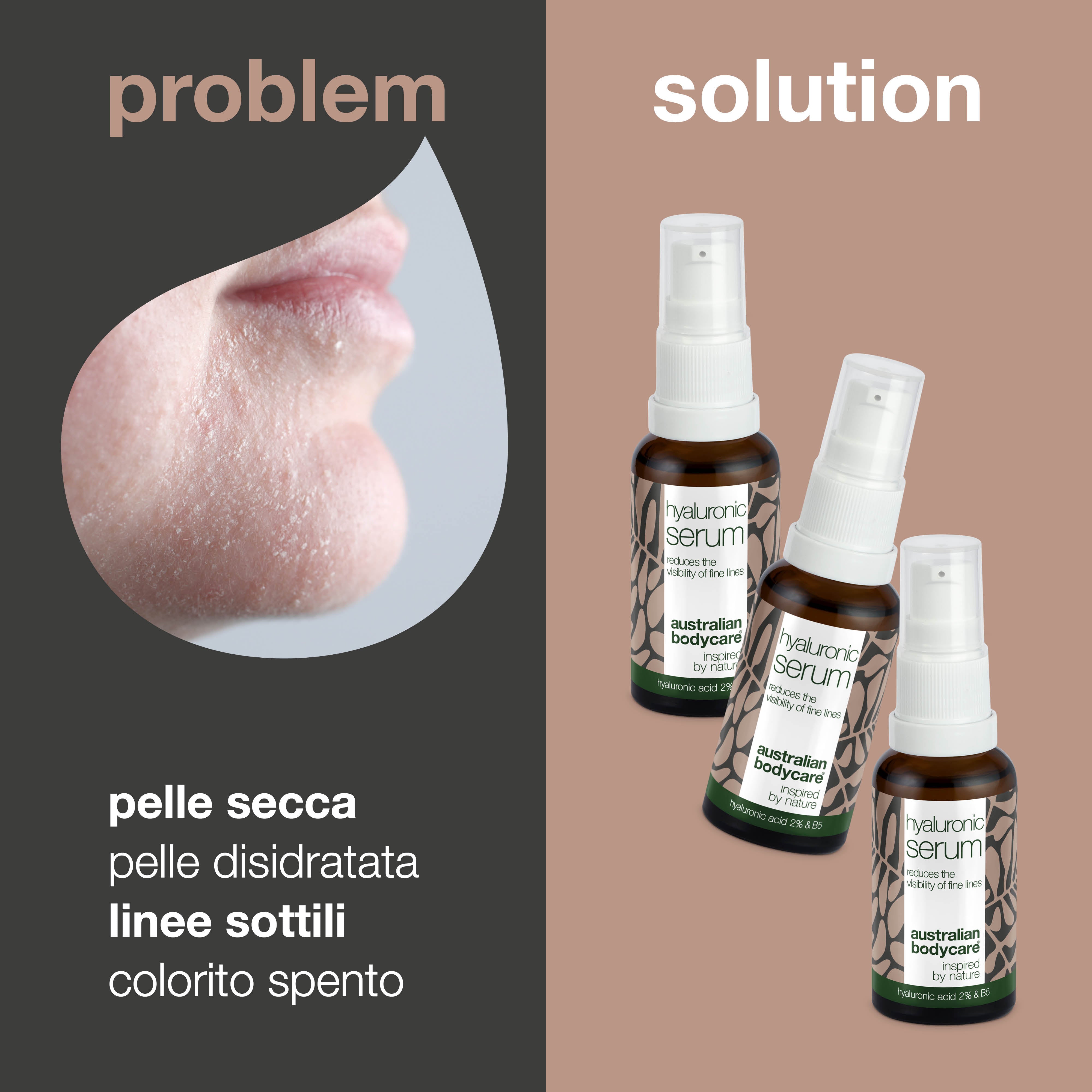 3 x siero all’acido ialuronico per una pelle luminosa e liscia — Con acido ialuronico 2% e vitamina B5, contro line sottili e rughe