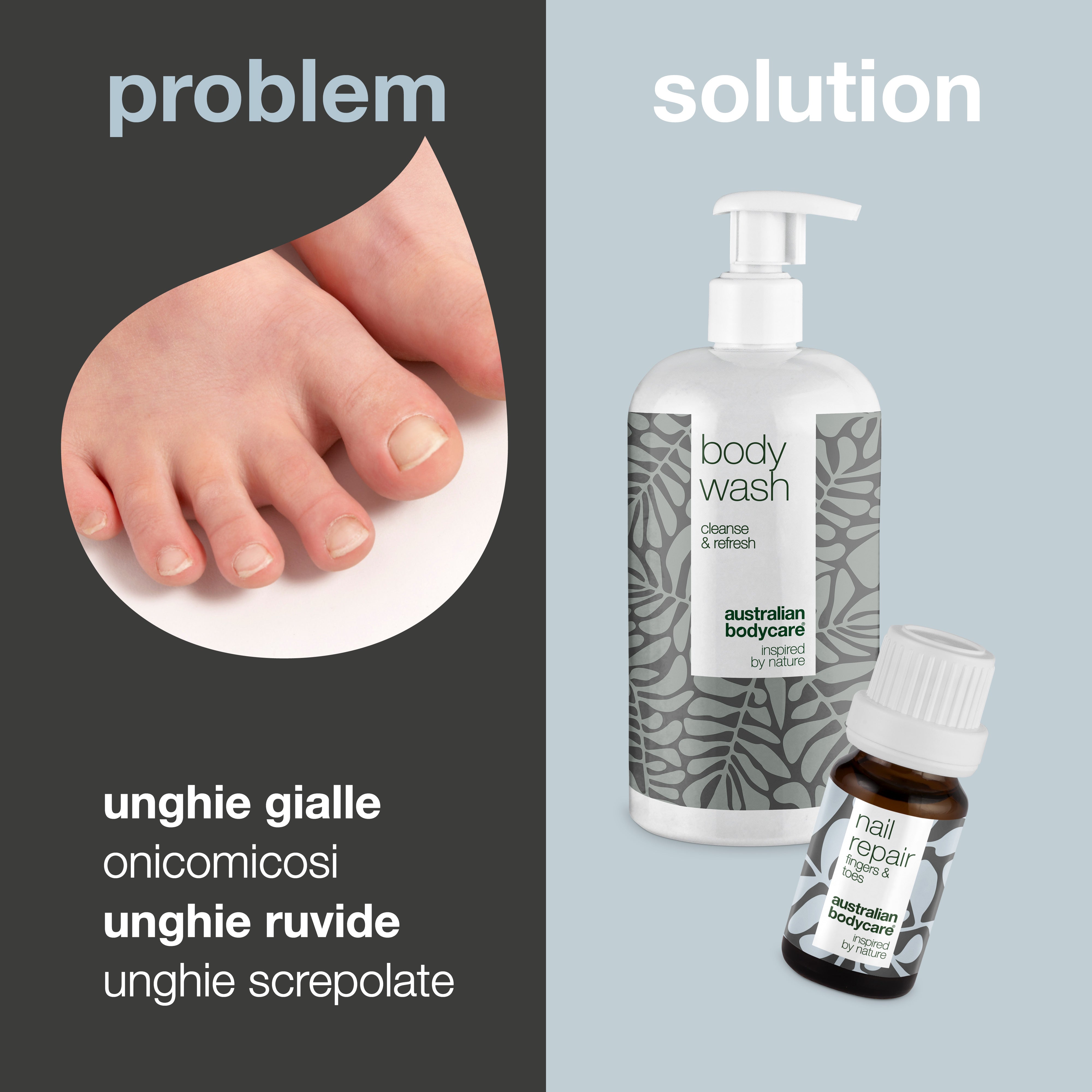 Cura delle unghie per unghie gialle e funghi alle unghie — 2 prodotti per unghie gialle e funghi alle unghie