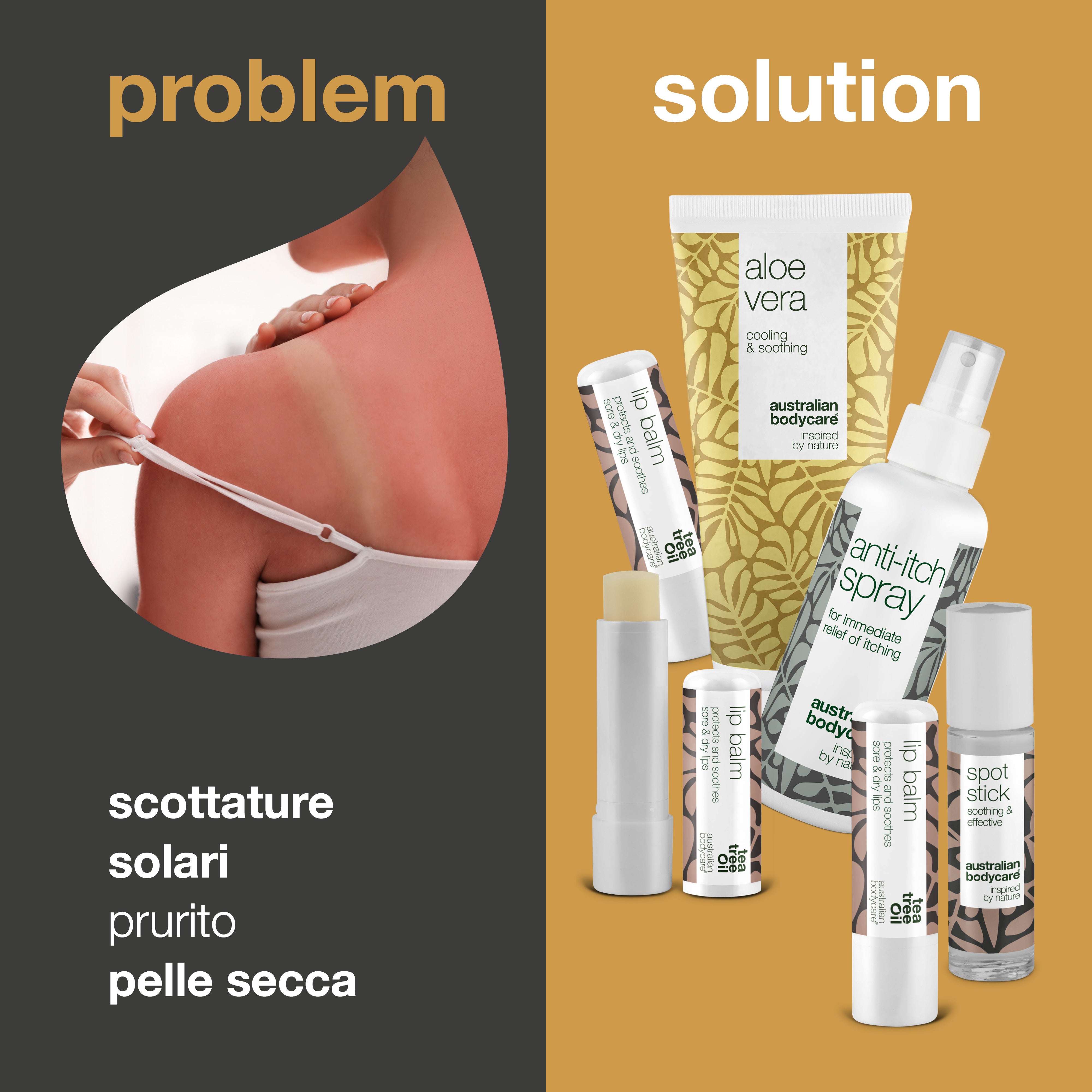 Prodotti per la cura della pelle per le vacanze estive: prodotti per curare le scottature solari e altri problemi della pelle