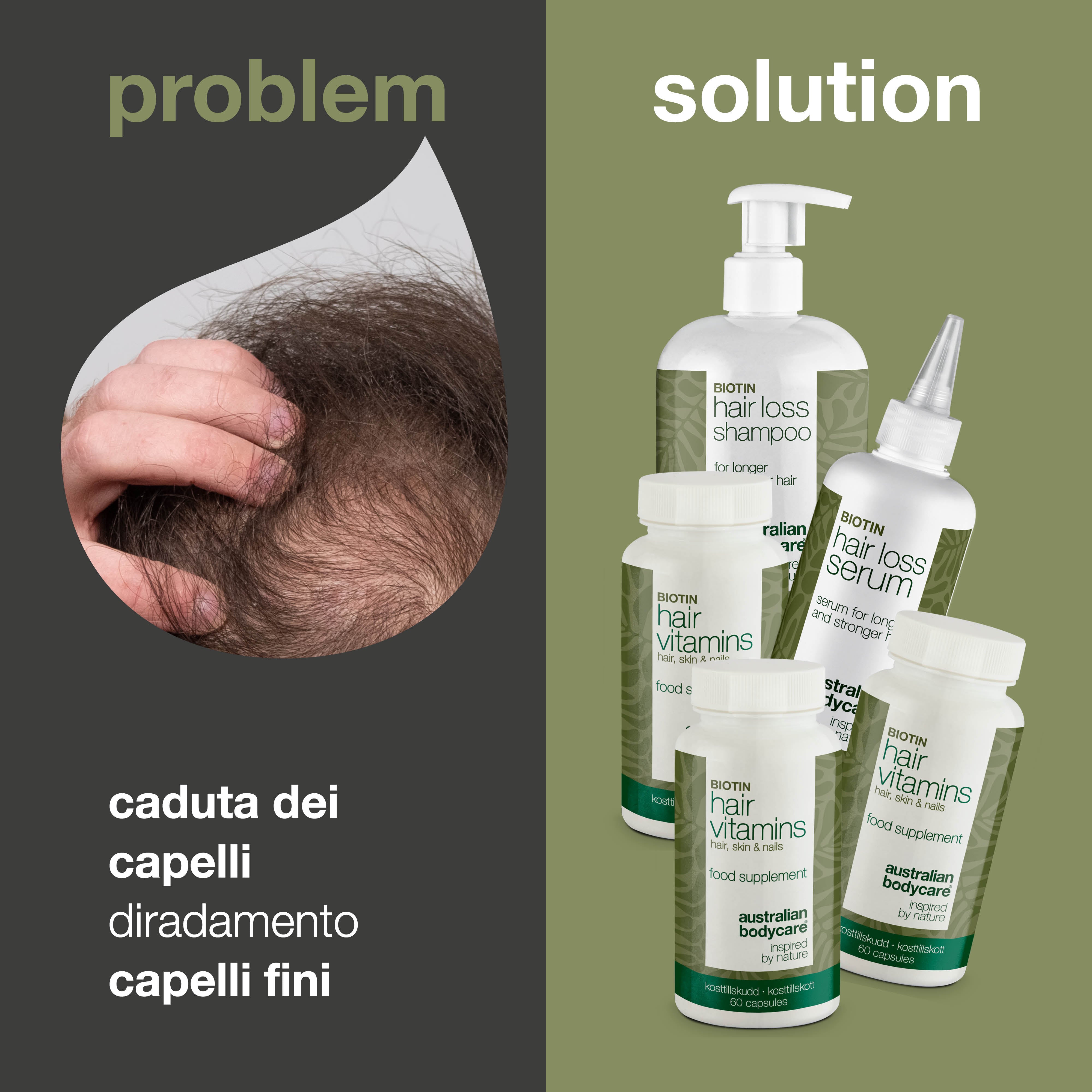 Kit XL contro la caduta dei capelli — 5 prodotti anticaduta con Biotina per capelli sottili