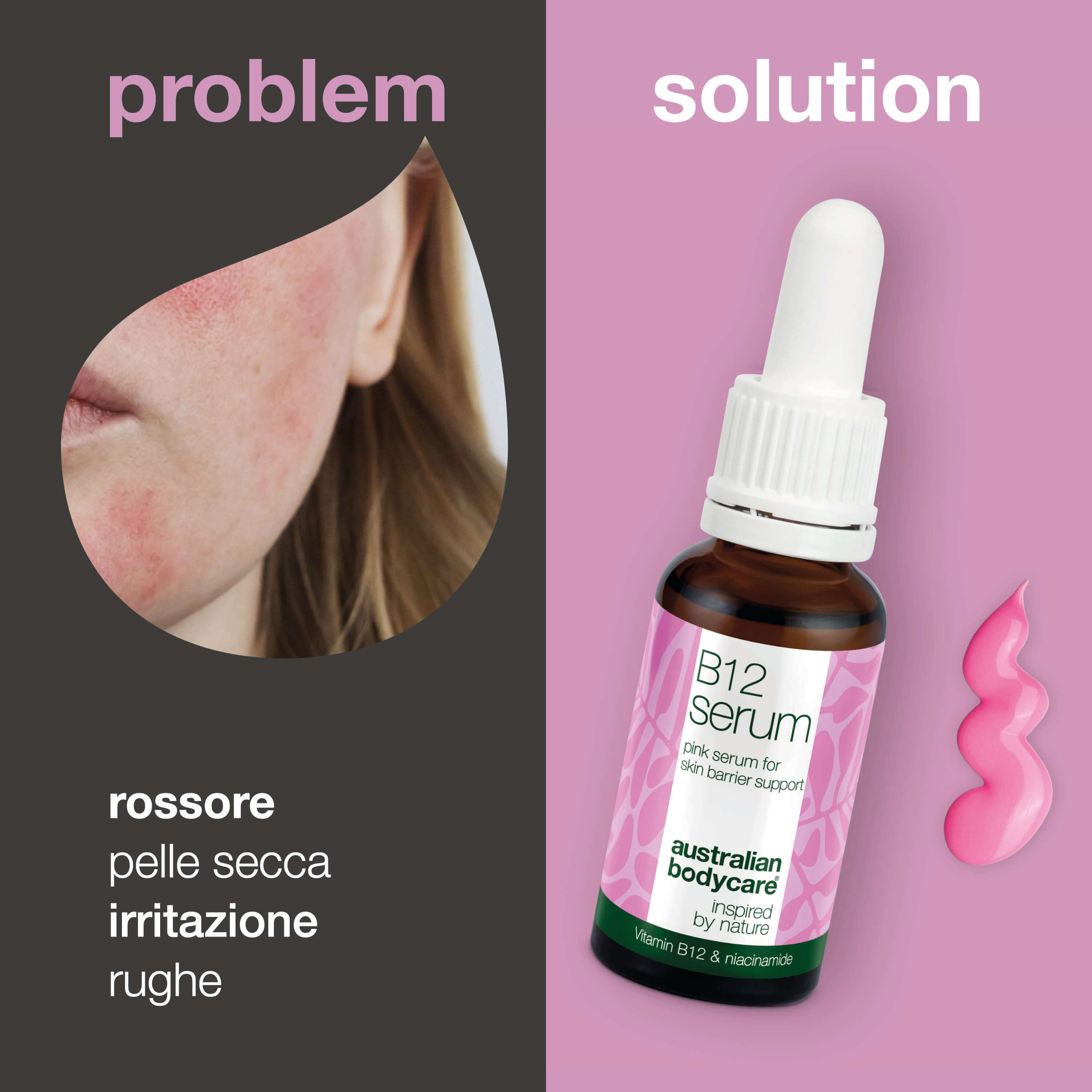 B12 Pink Serum – Riduci rossori e rinforza la barriera cutanea — B12 Pink Serum riduce i rossori e rinforza la barriera cutanea. Ideale per pelle secca e sensibile. Scopri una pelle sana & luminosa.