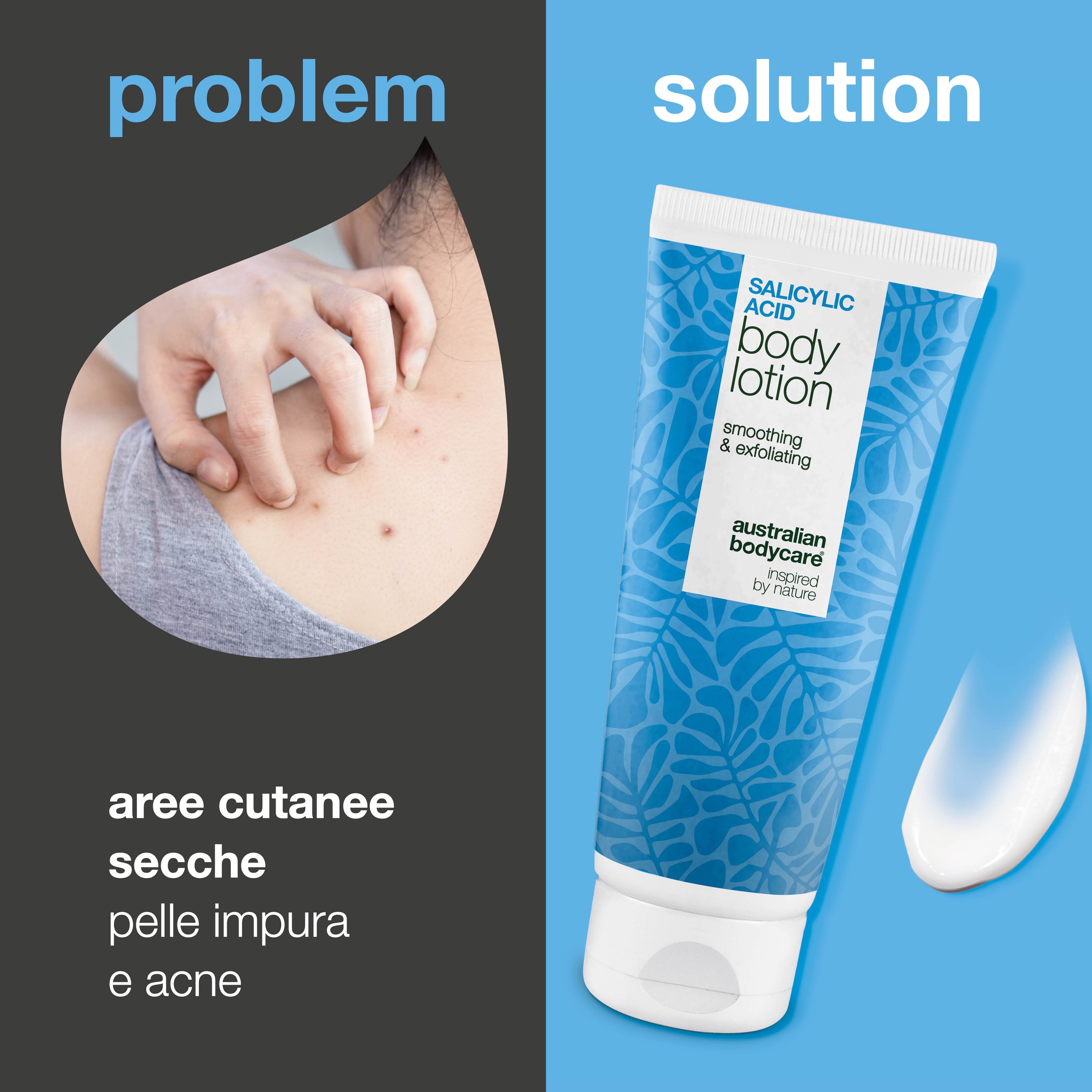 Lozione corpo con acido salicilico – pelle secca e ruvida — Lozione con acido salicilico che esfolia, idrata e aiuta a levigare la pelle secca e ruvida. Perfetta per l’uso quotidiano.