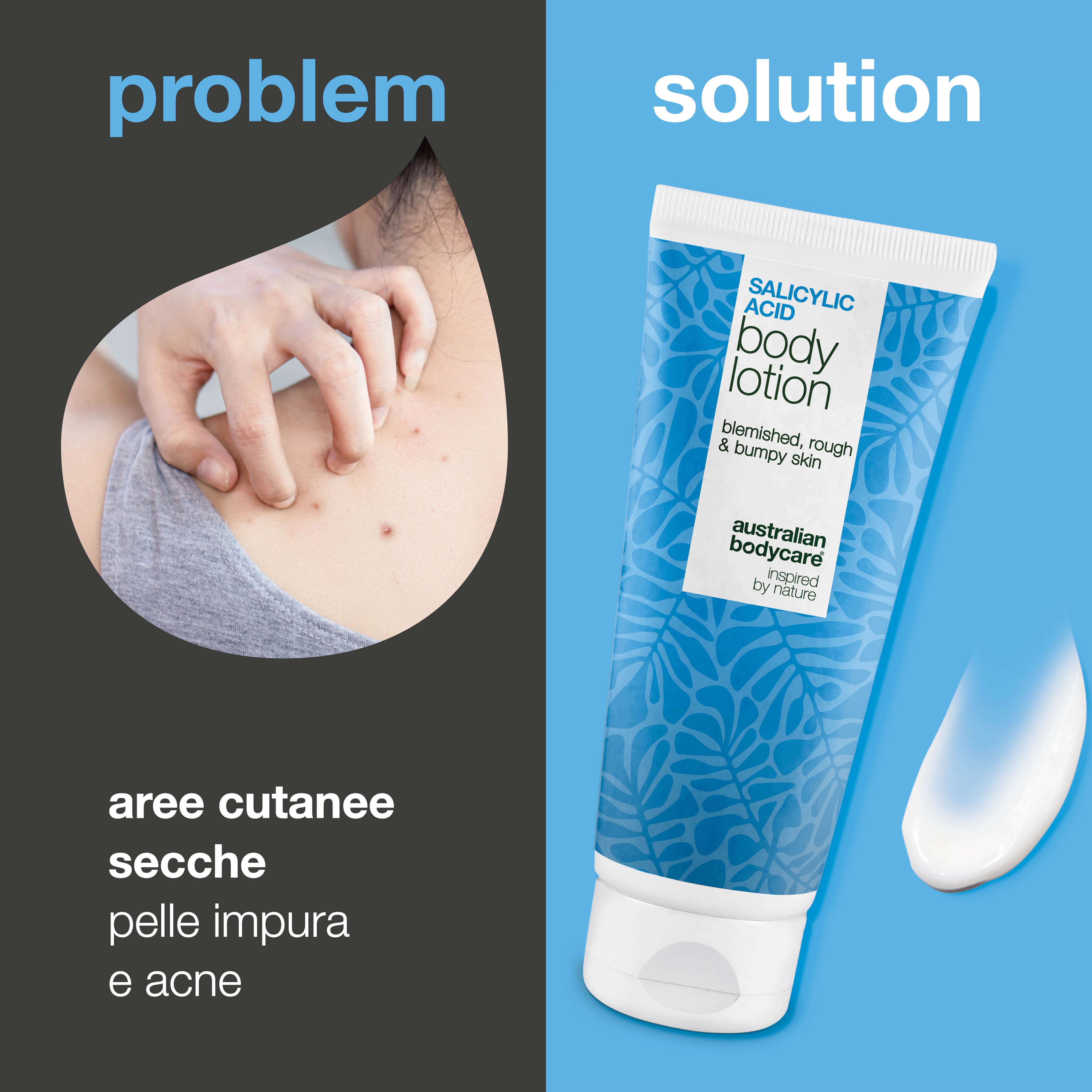 Lozione corpo con acido salicilico – pelle secca e ruvida — Lozione con acido salicilico che esfolia, idrata e aiuta a levigare la pelle secca e ruvida. Perfetta per l’uso quotidiano.