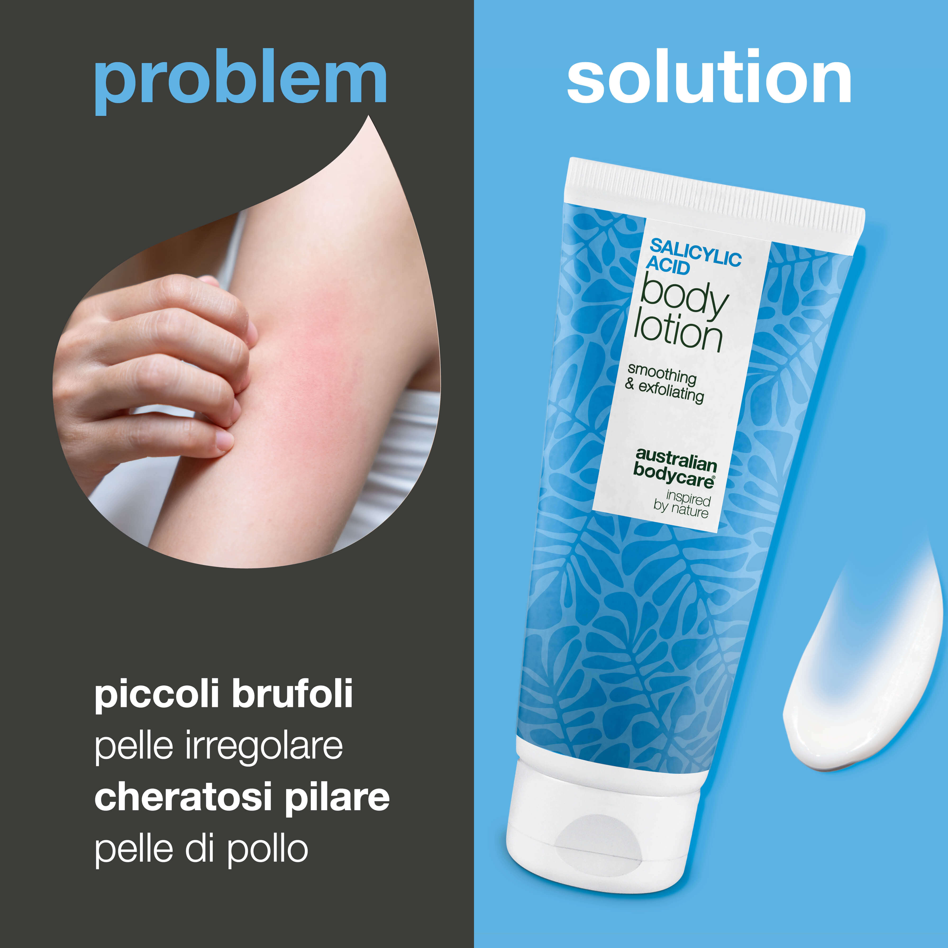Lozione cheratosi pilare che leviga la pelle ruvida e i puntini. Uso quotidiano. Con acido salicilico, niacinamide e zinco PCA.