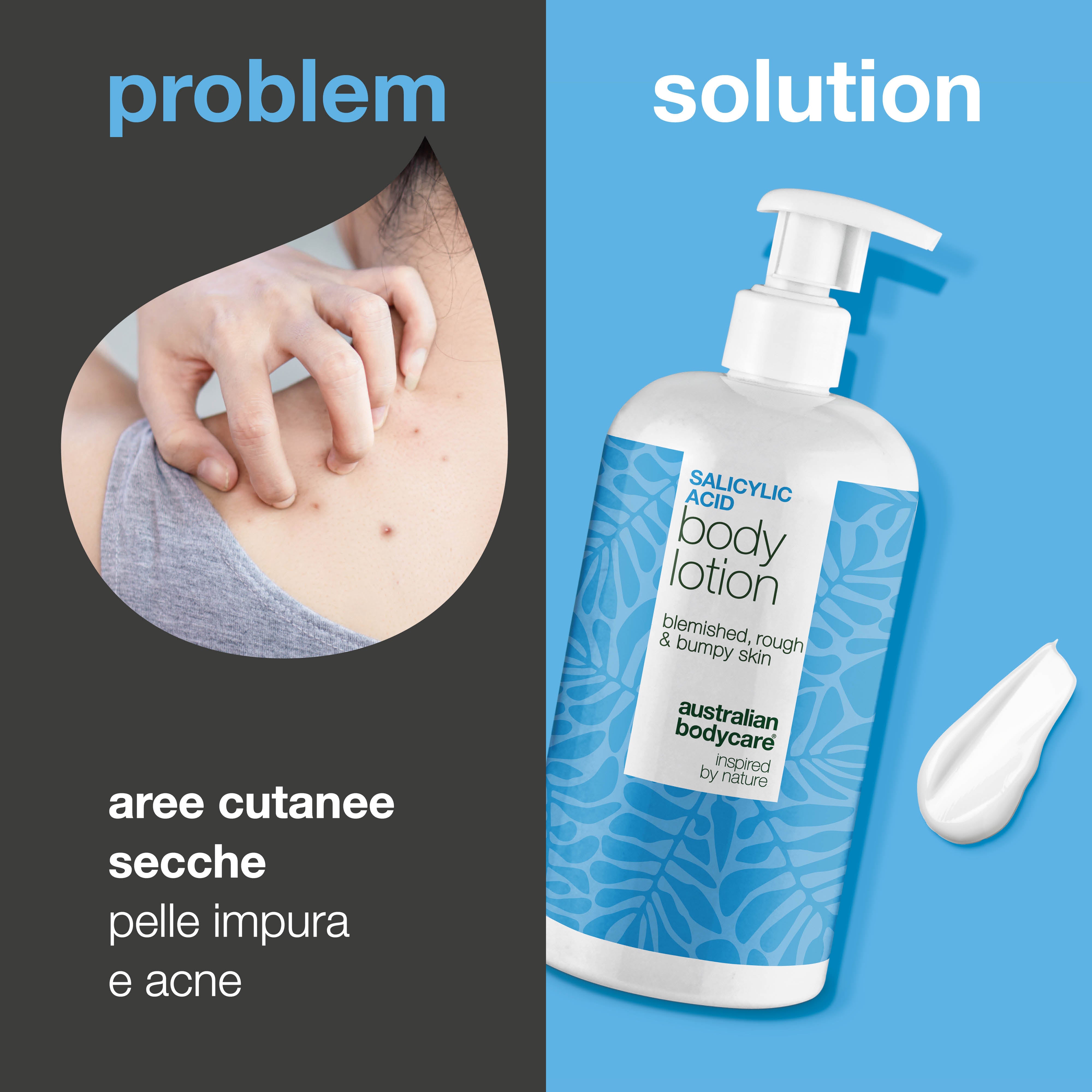 Lozione corpo con acido salicilico – pelle secca e ruvida — Lozione con acido salicilico che esfolia, idrata e aiuta a levigare la pelle secca e ruvida. Perfetta per l’uso quotidiano.