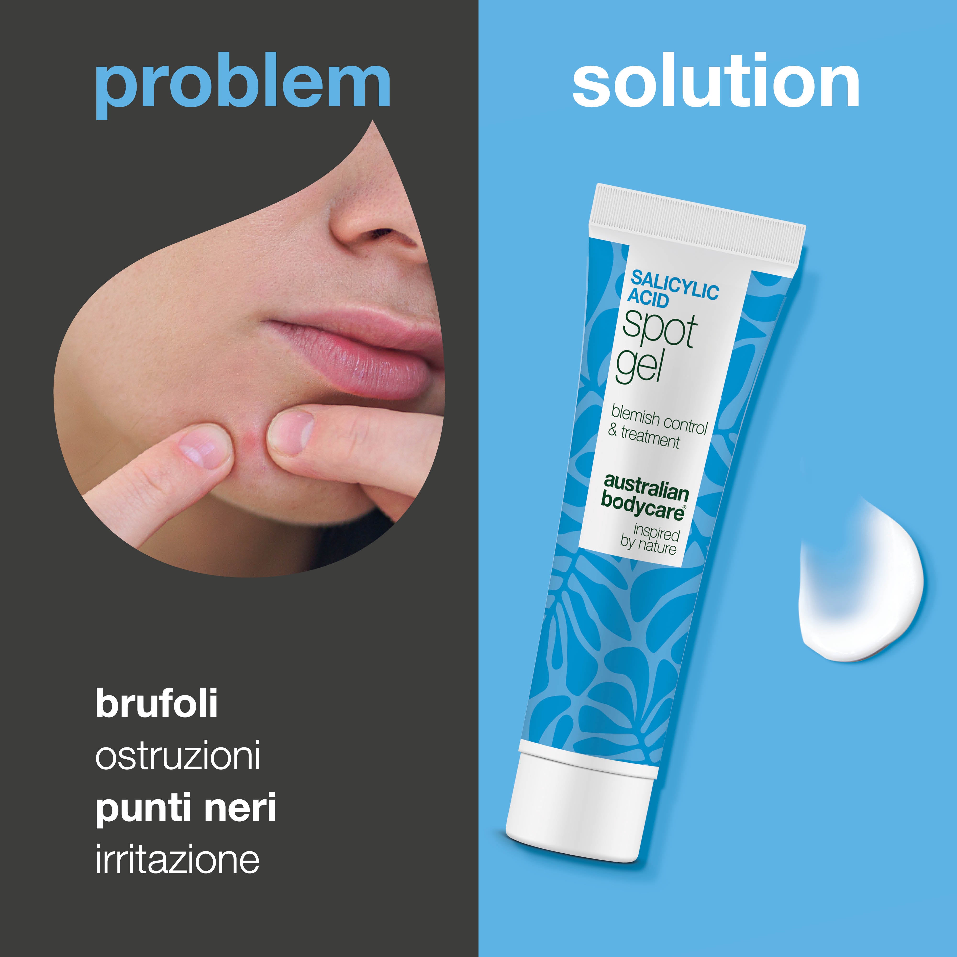 Gel spot all’acido salicilico contro brufoli, punti neri e rossori – purifica e calma la pelle