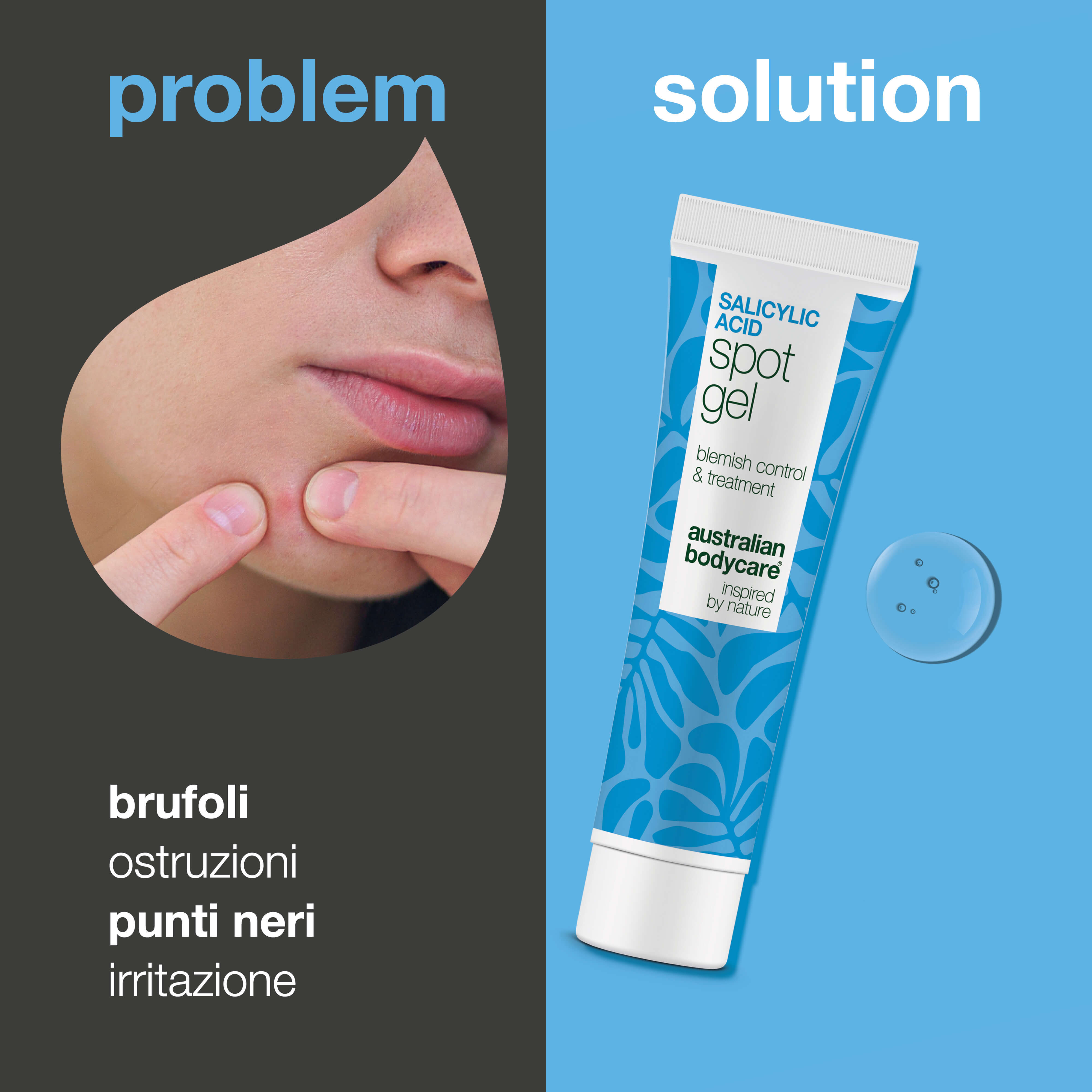 Gel Anti-Imperfezioni all’Acido Salicilico per brufoli — Gel Anti-Imperfezioni all’Acido Salicilico pulisce i pori e bilancia la pelle. Trattamento efficace con acido salicilico.