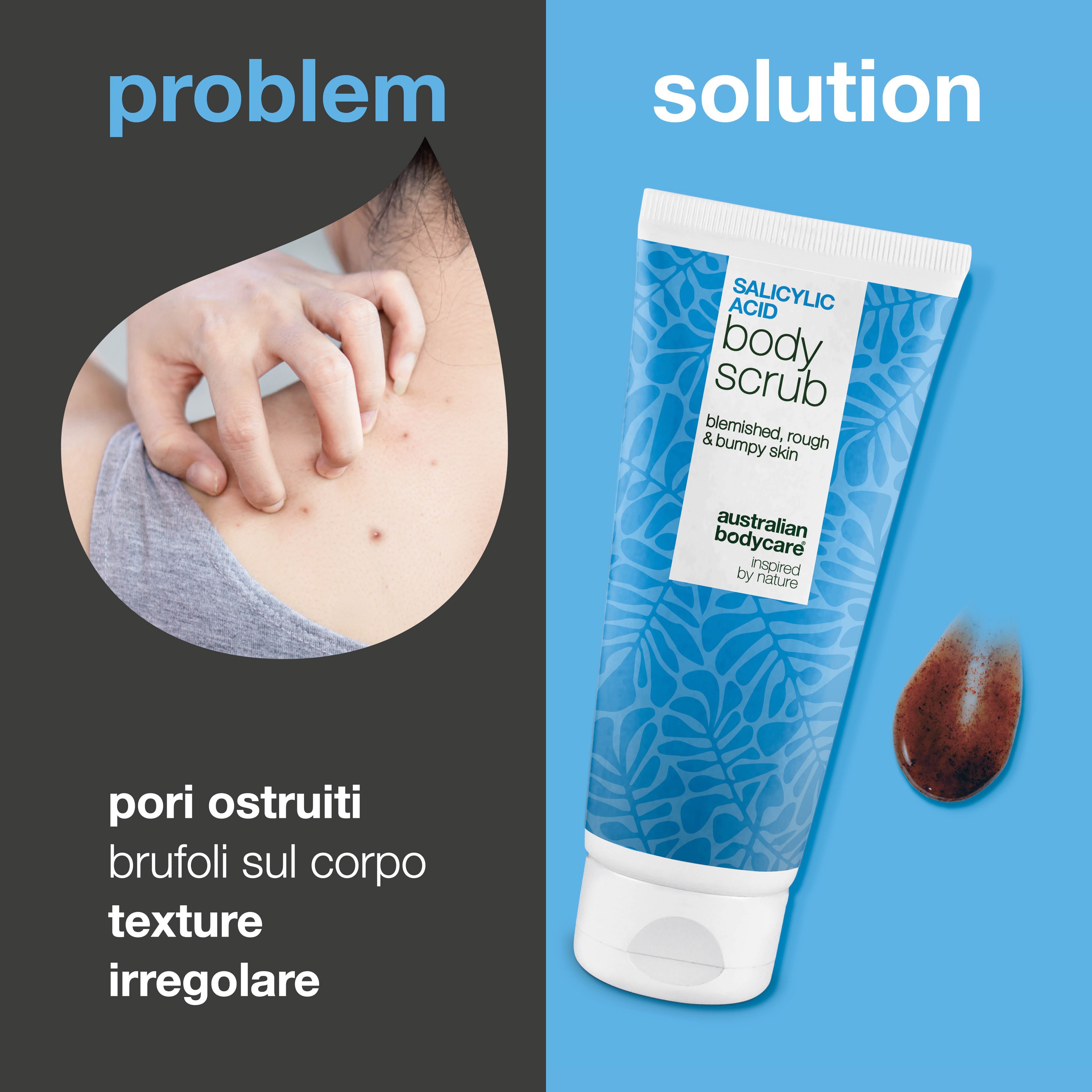 Body Scrub con acido salicilico contro brufoli e pori ostruiti — Body Scrub con acido salicilico elimina brufoli e impurità. Con acido salicilico, acido glicólico e allantoina.