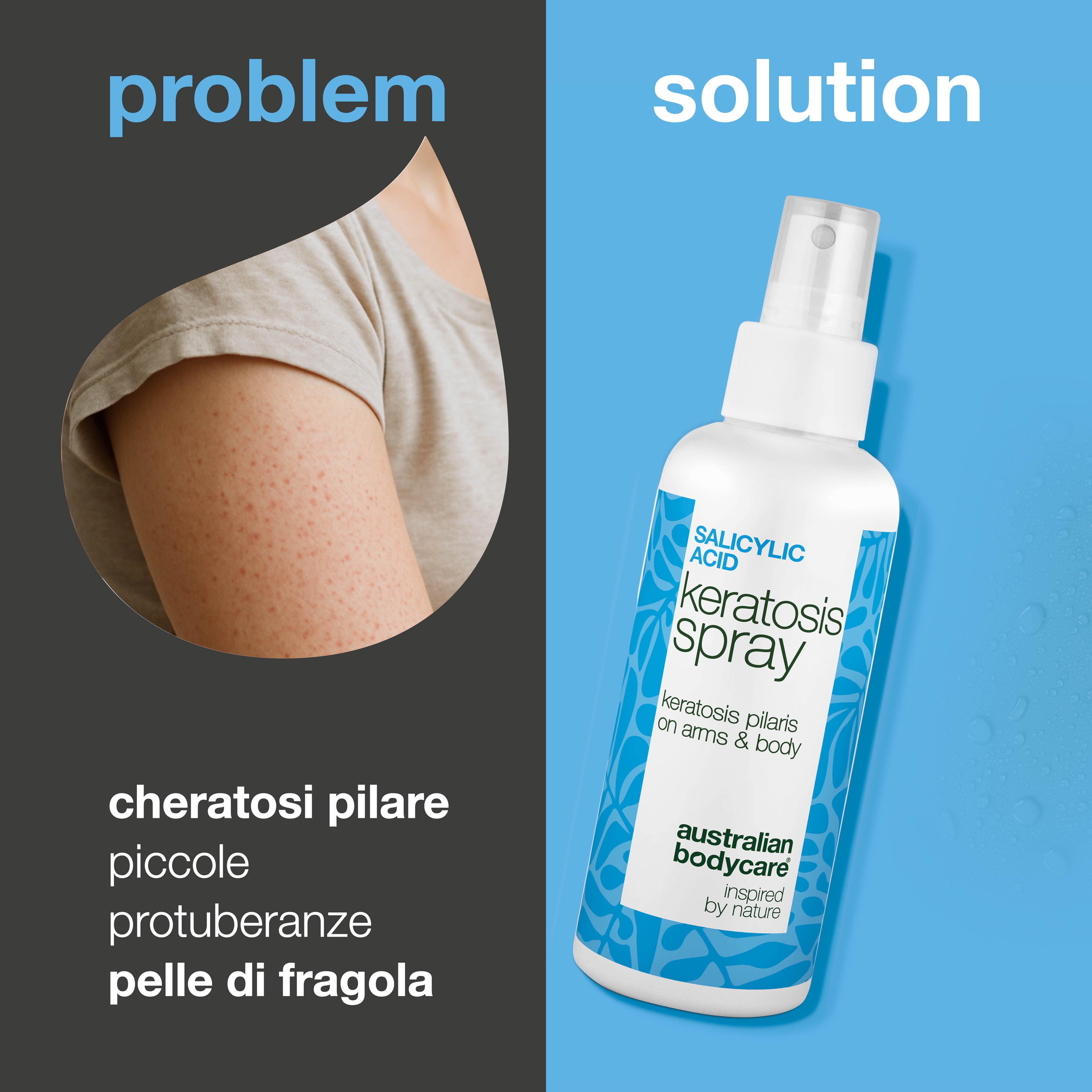 Spray cheratosi pilare per pelle ruvida e pelle a fragola — Keratosis pilaris spray leviga la pelle ruvida e a buccia d’arancia. Con acido salicilico per esfoliazione e pori puliti.