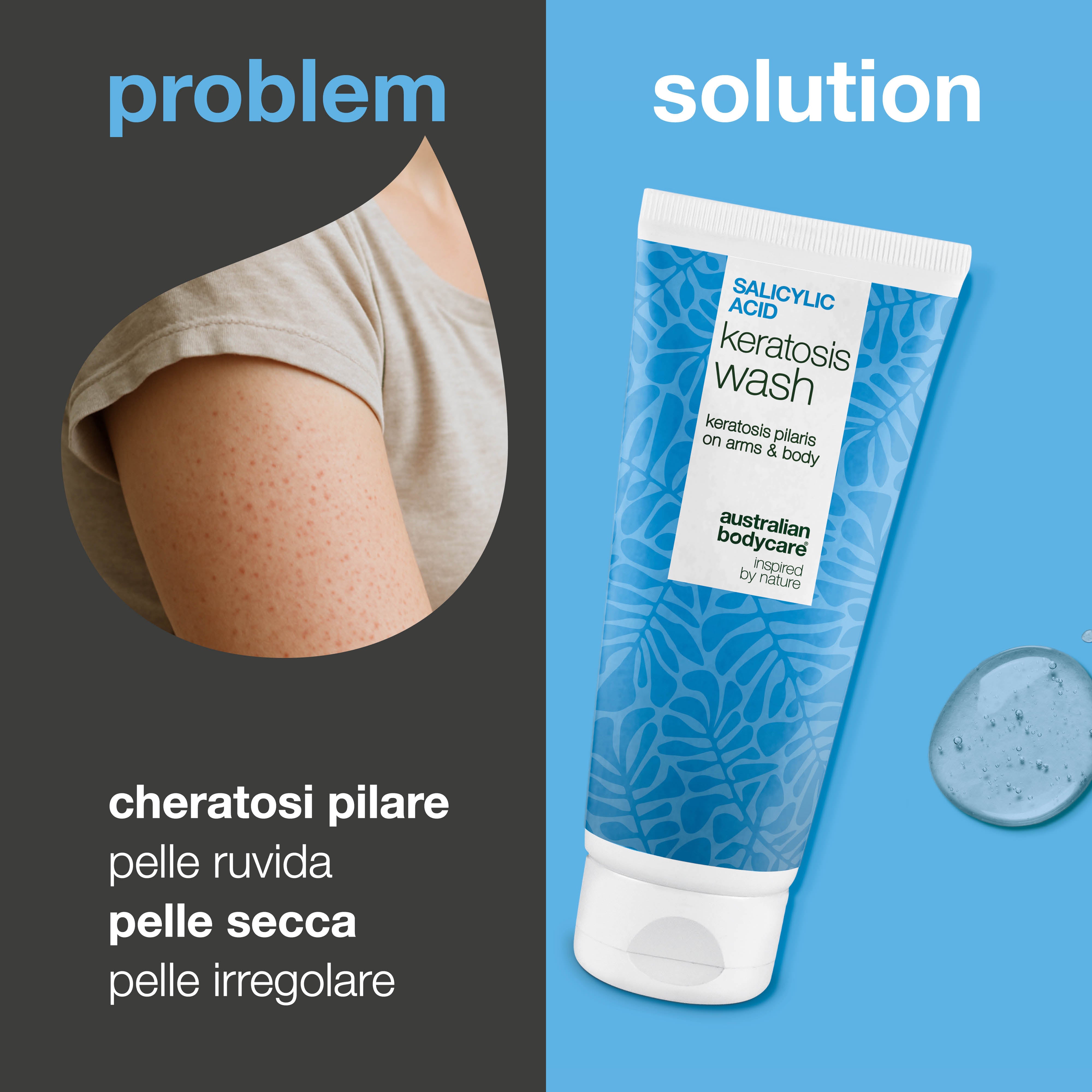 Keratosis Pilaris Body Wash contro la cheratosi pilare, pori ostruiti e rossori. Con acido salicilico, niacinamide, zinco PCA e vitamina E per risultati visibili.