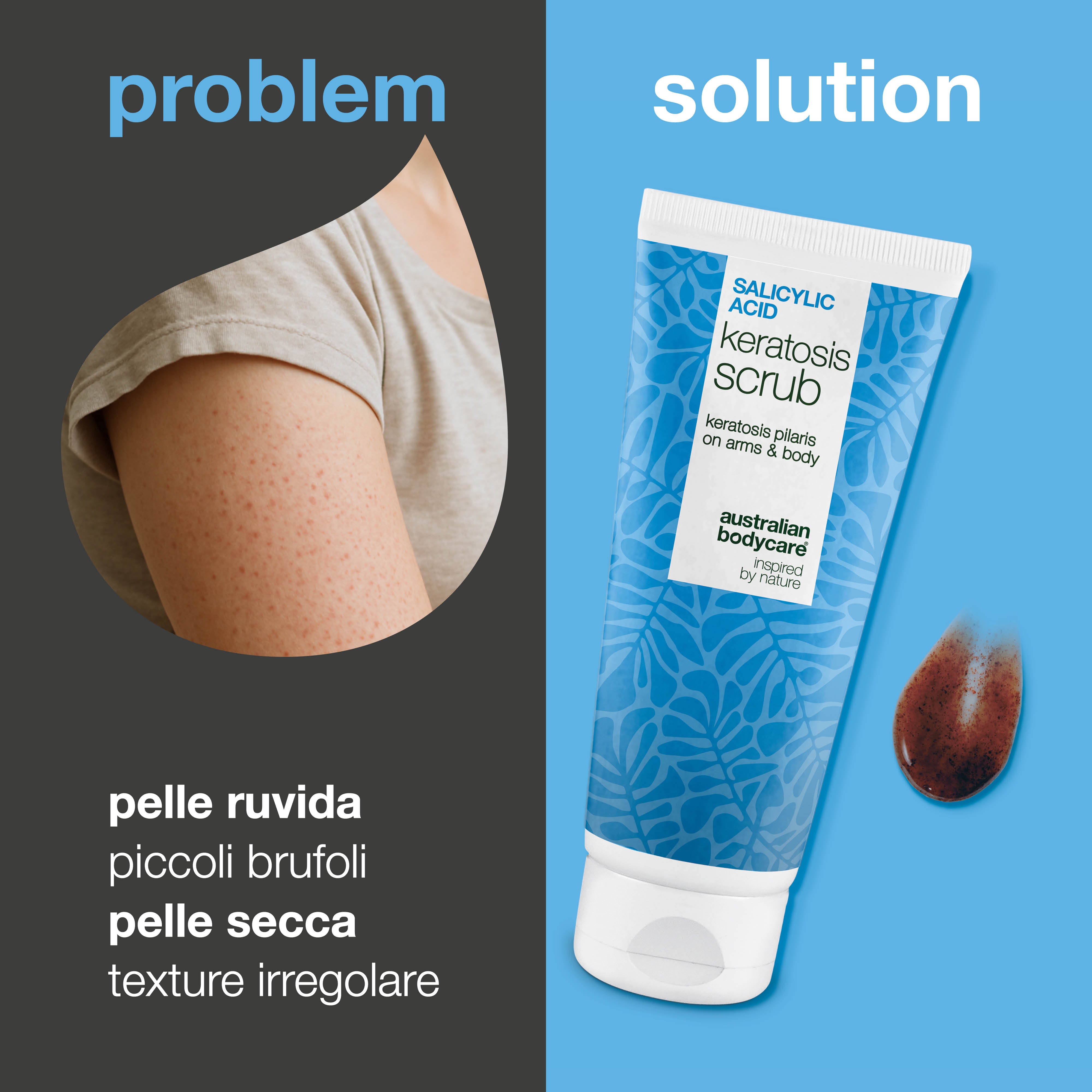 Body Scrub Cheratosi Pilare elimina cellule morte e riduce le imperfezioni. Leviga la pelle con acido salicilico, acido glicolico, allantoina e glicerina.