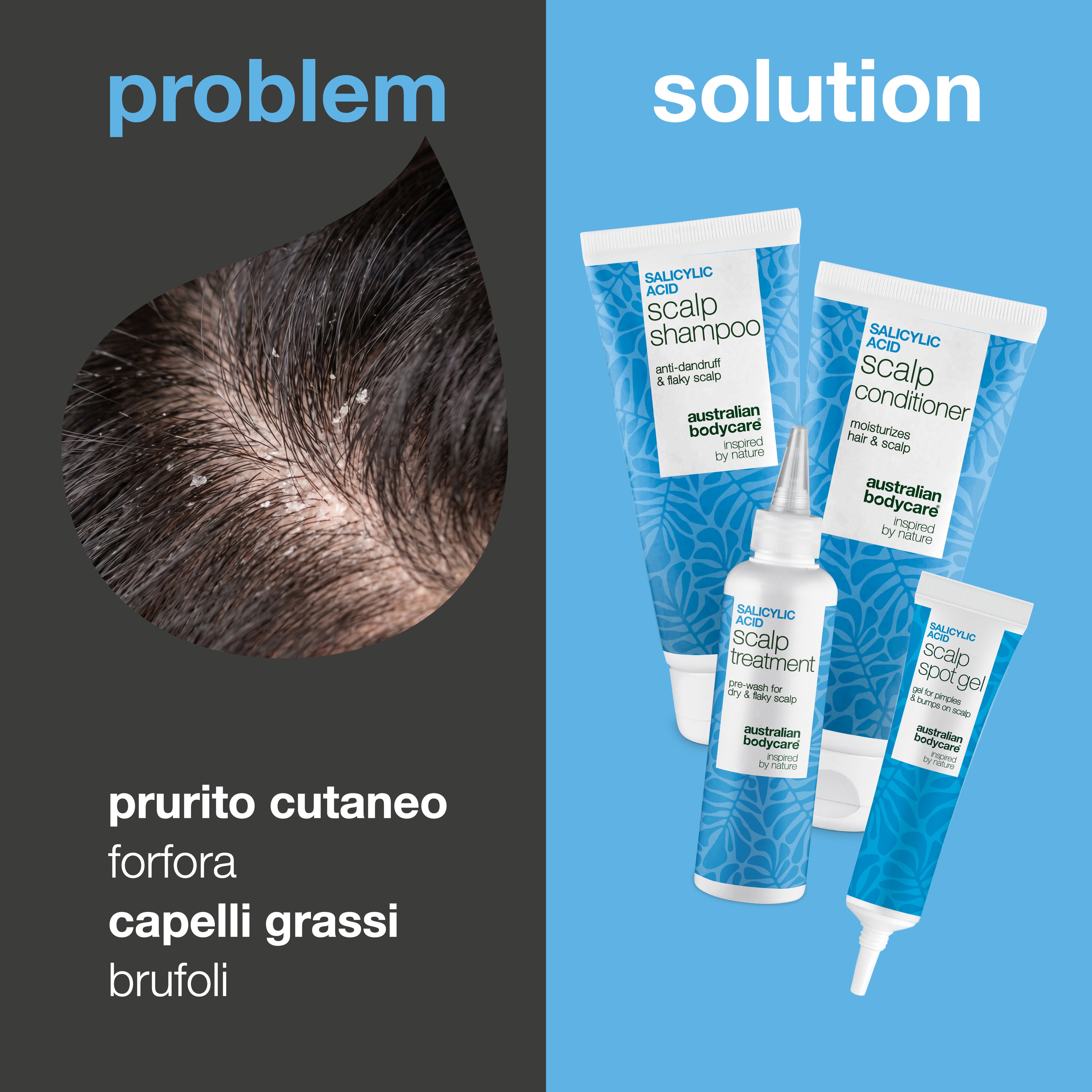 Problema e soluzione: primo piano della forfora sul cuoio capelluto accanto ai quattro prodotti contro prurito, forfora e brufoli