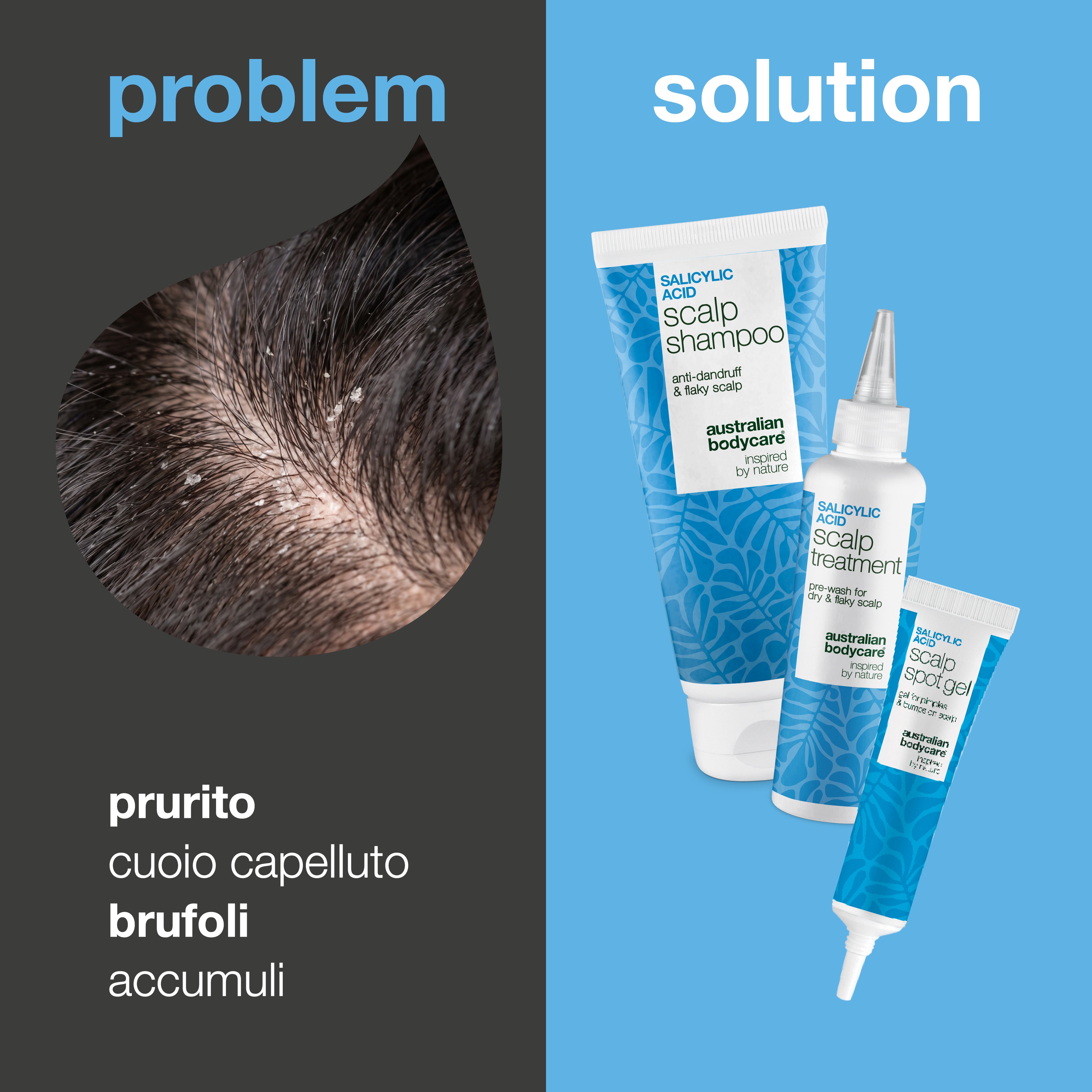 Problema e soluzione: primo piano di prurito, capelli grassi e accumuli sul cuoio capelluto accanto ai tre prodotti del set