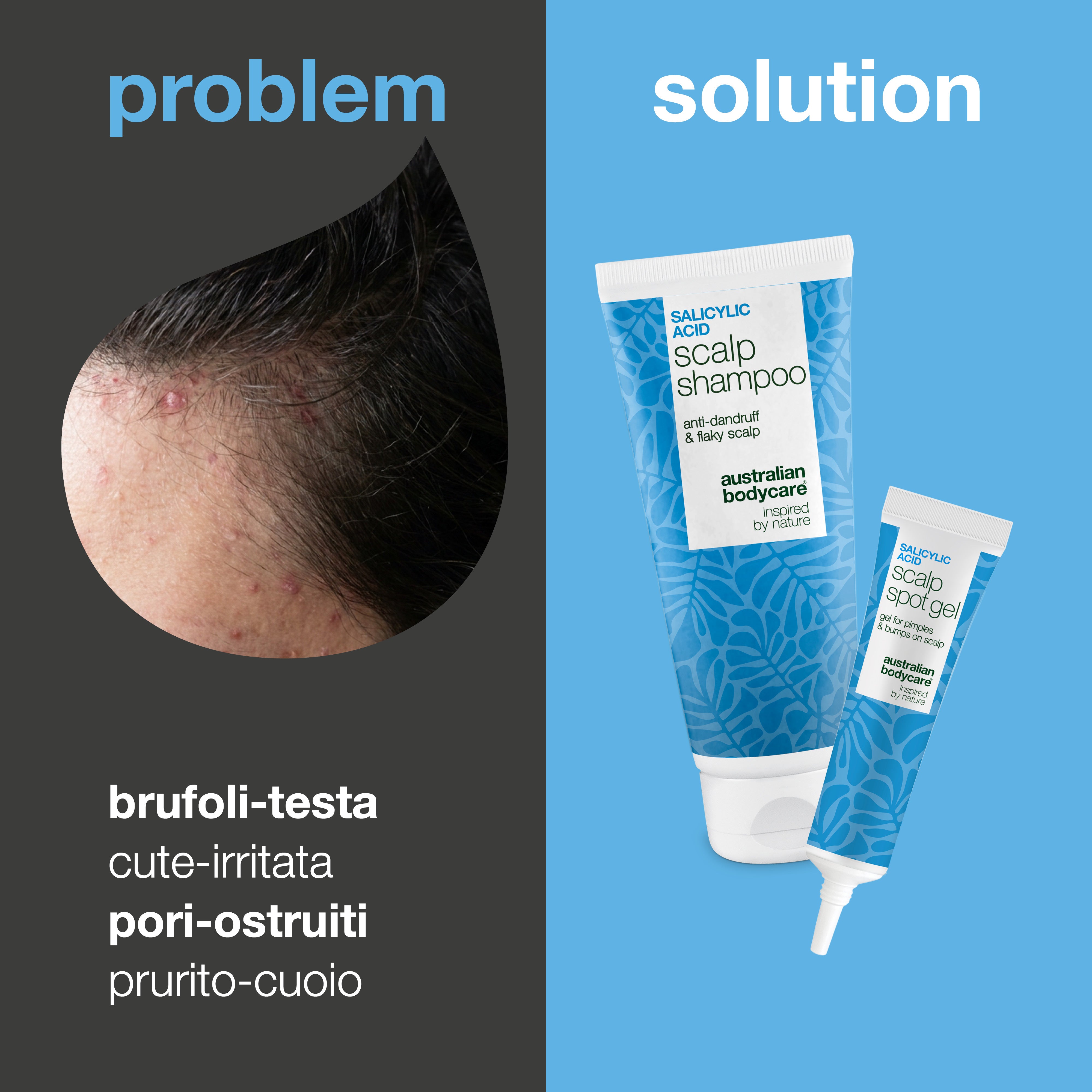 Problema e soluzione: primo piano di brufoli e bollicine sul cuoio capelluto accanto a shampoo e gel del set