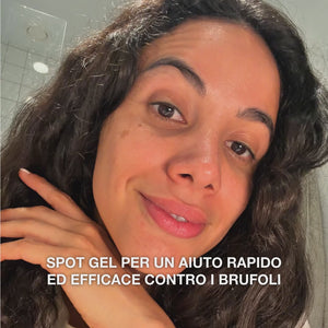 Gel Anti-Imperfezioni all’Acido Salicilico per brufoli — Gel Anti-Imperfezioni all’Acido Salicilico pulisce i pori e bilancia la pelle. Trattamento efficace con acido salicilico.