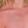 Donna applica body spray all’acido salicilico – prima/dopo con meno acne e pelle più pulita.